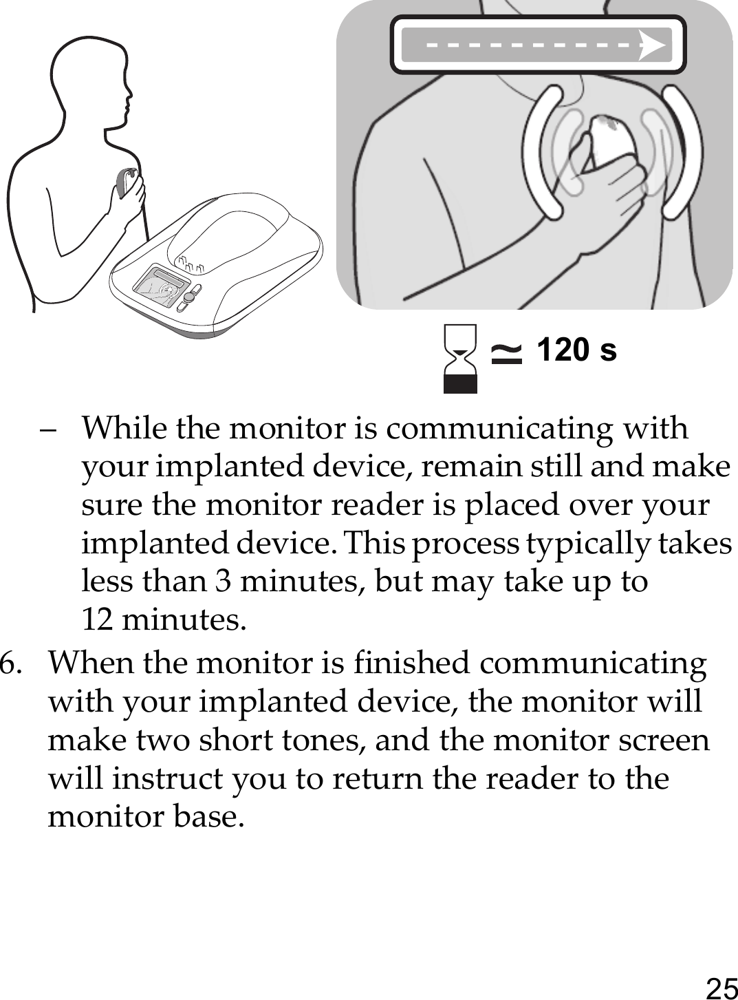 25– While the monitor is communicating with your implanted device, remain still and make sure the monitor reader is placed over your implanted device. This process typically takes less than 3 minutes, but may take up to 12 minutes. 6. When the monitor is finished communicating with your implanted device, the monitor will make two short tones, and the monitor screen will instruct you to return the reader to the monitor base.120 s