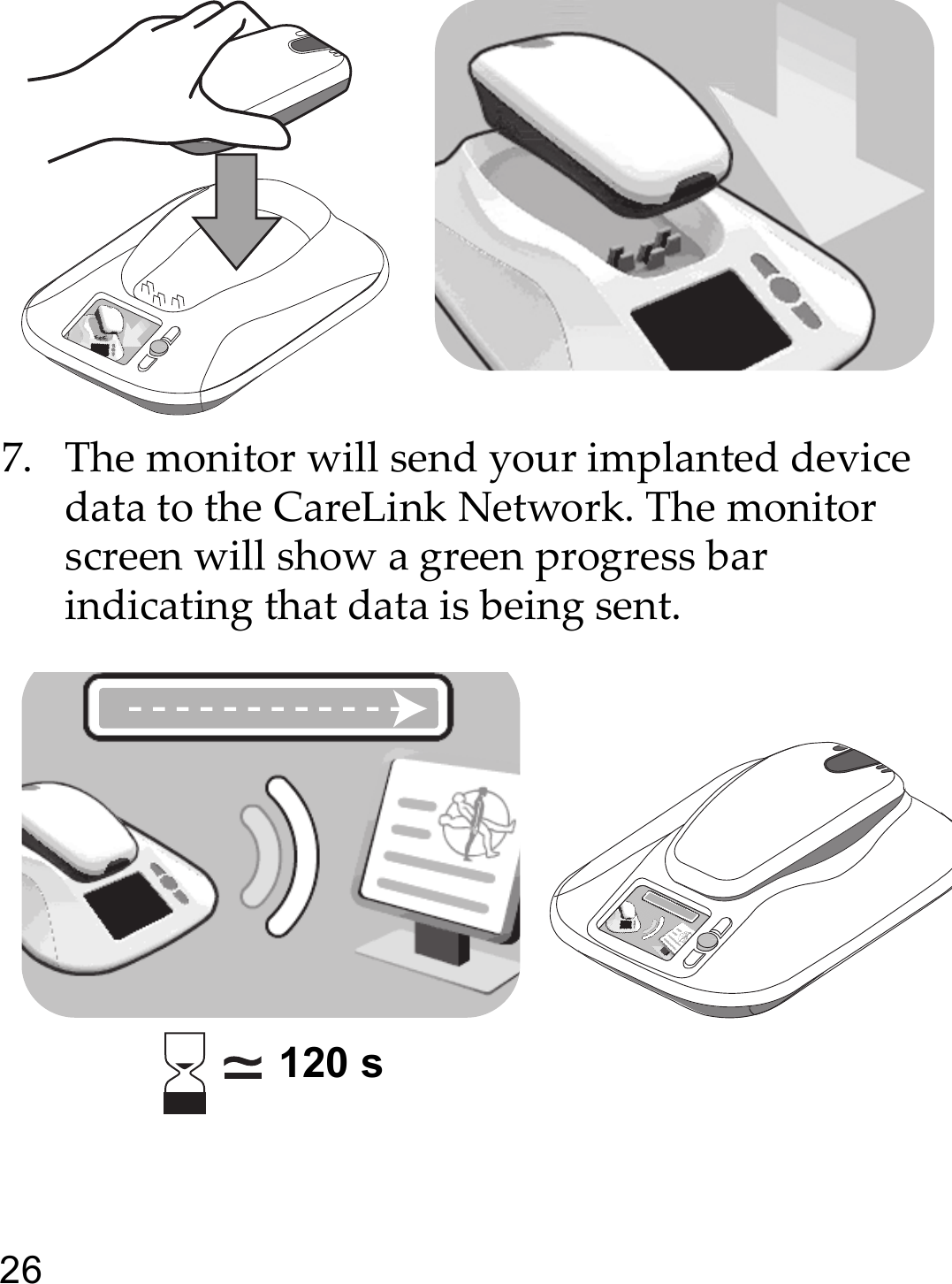 267. The monitor will send your implanted device data to the CareLink Network. The monitor screen will show a green progress bar indicating that data is being sent.120 s