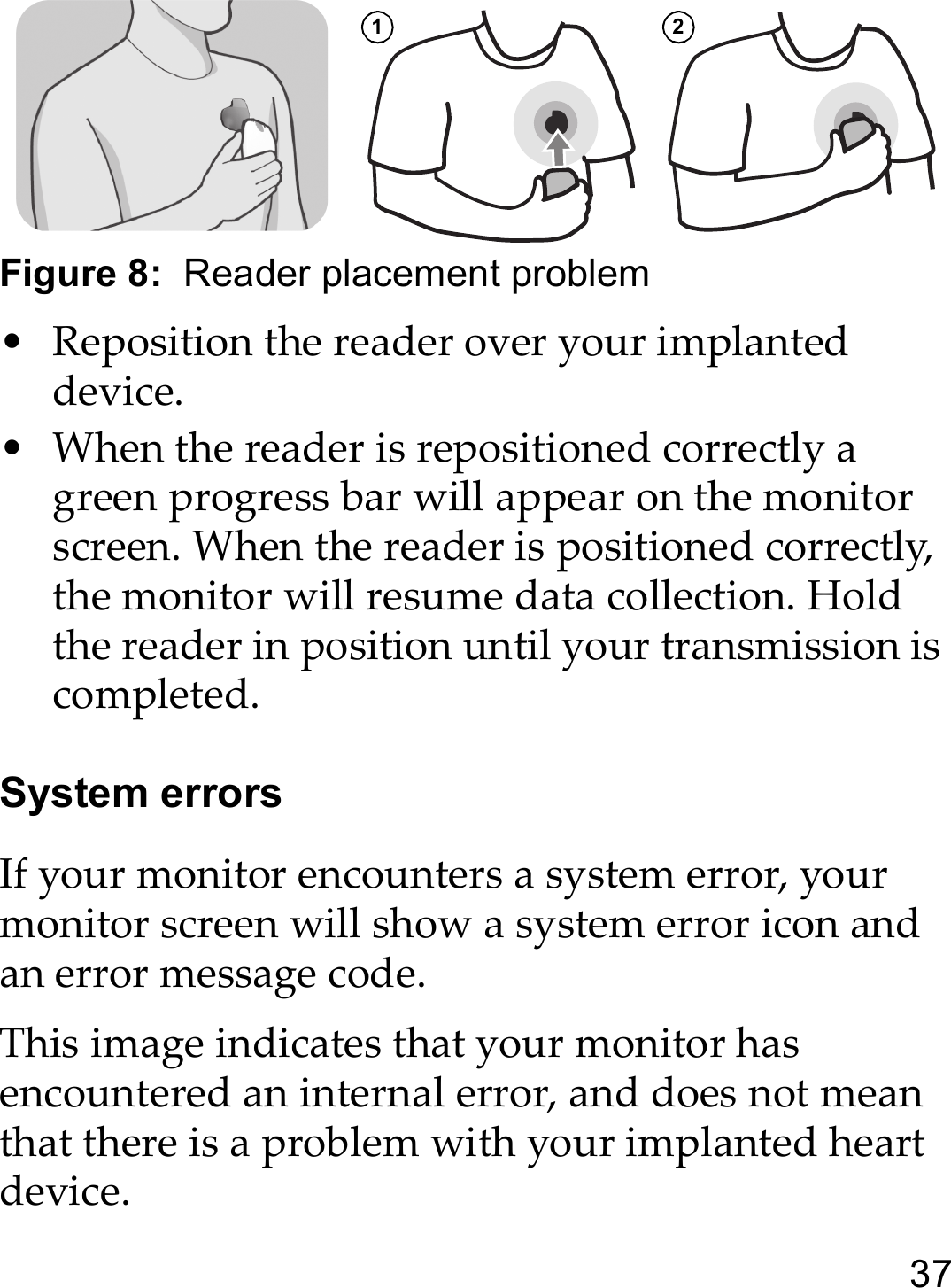 37Figure 8:  Reader placement problem • Reposition the reader over your implanted device. • When the reader is repositioned correctly a green progress bar will appear on the monitor screen. When the reader is positioned correctly, the monitor will resume data collection. Hold the reader in position until your transmission is completed.System errorsIf your monitor encounters a system error, your monitor screen will show a system error icon and an error message code.This image indicates that your monitor has encountered an internal error, and does not mean that there is a problem with your implanted heart device.1 2