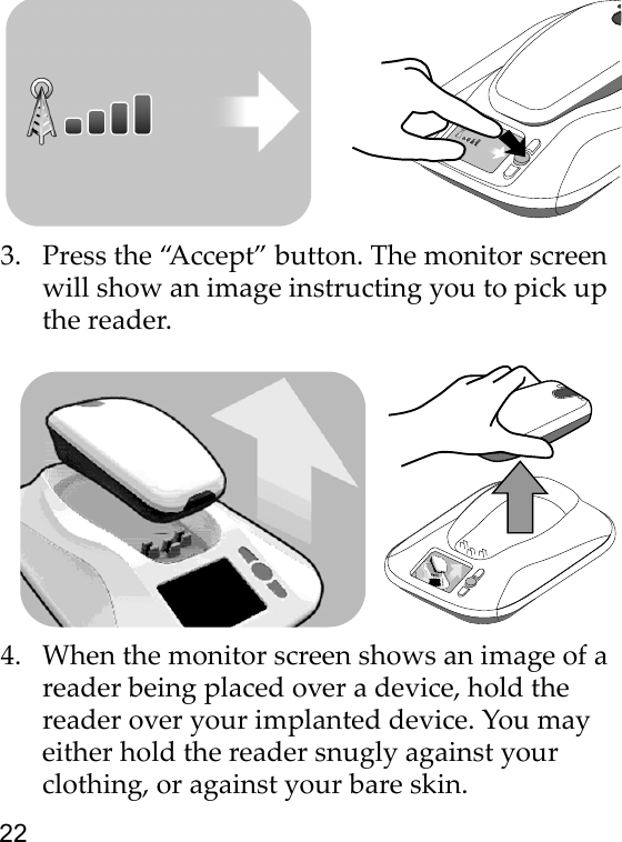 223. Press the “Accept” button. The monitor screen will show an image instructing you to pick up the reader.4. When the monitor screen shows an image of a reader being placed over a device, hold the reader over your implanted device. You may either hold the reader snugly against your clothing, or against your bare skin.