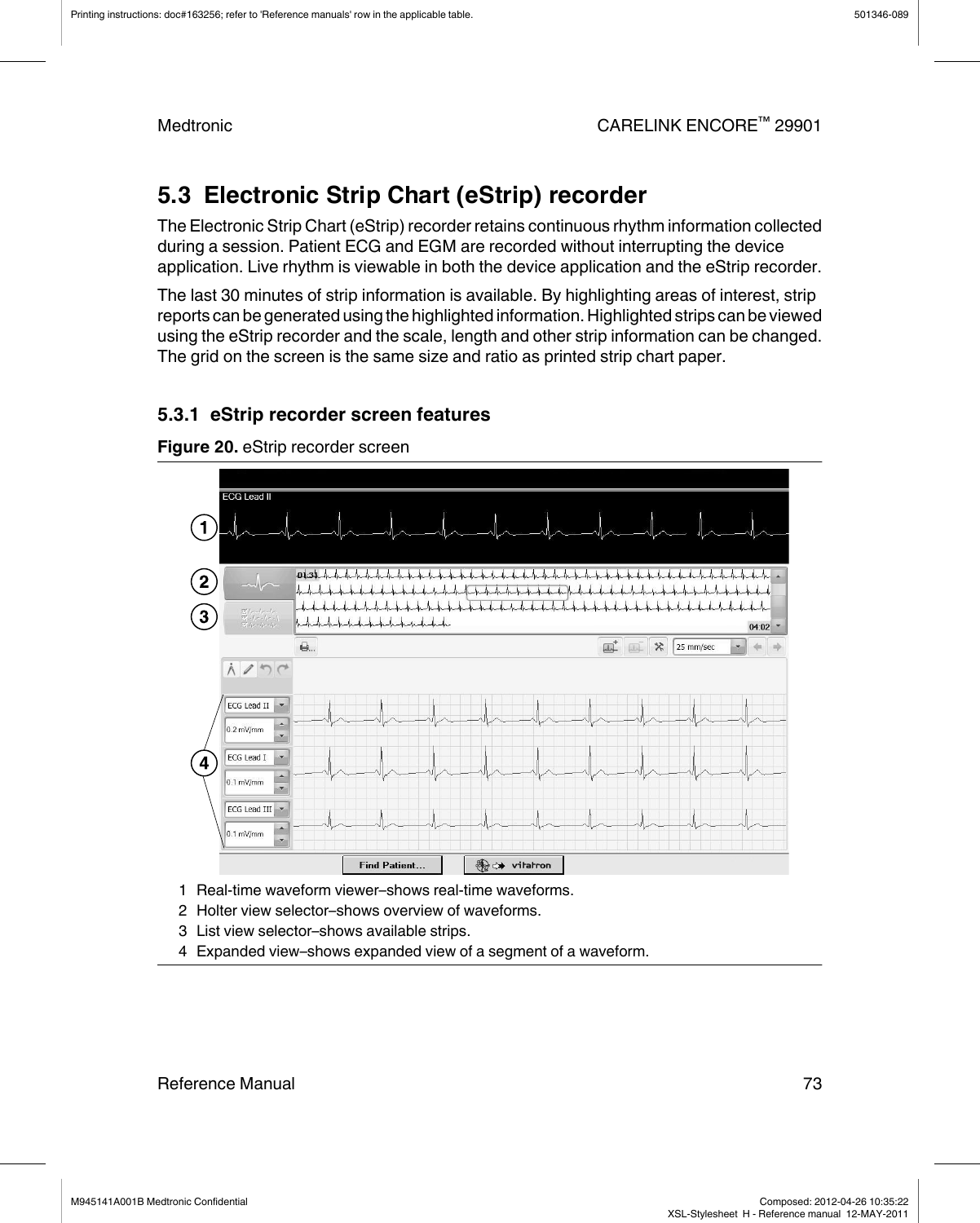 5.3  Electronic Strip Chart (eStrip) recorderThe Electronic Strip Chart (eStrip) recorder retains continuous rhythm information collectedduring a session. Patient ECG and EGM are recorded without interrupting the deviceapplication. Live rhythm is viewable in both the device application and the eStrip recorder.The last 30 minutes of strip information is available. By highlighting areas of interest, stripreports can be generated using the highlighted information. Highlighted strips can be viewedusing the eStrip recorder and the scale, length and other strip information can be changed.The grid on the screen is the same size and ratio as printed strip chart paper.5.3.1  eStrip recorder screen featuresFigure 20. eStrip recorder screen1 Real-time waveform viewer–shows real-time waveforms.2 Holter view selector–shows overview of waveforms.3 List view selector–shows available strips.4 Expanded view–shows expanded view of a segment of a waveform.Printing instructions: doc#163256; refer to &apos;Reference manuals&apos; row in the applicable table. 501346-089Medtronic CARELINK ENCORE™ 29901Reference Manual 73M945141A001B Medtronic Confidential   Composed: 2012-04-26 10:35:22XSL-Stylesheet  H - Reference manual  12-MAY-2011