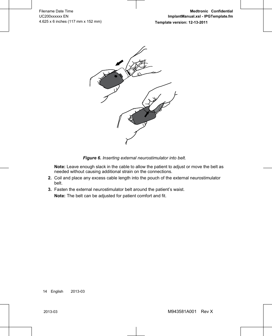 Figure 6. Inserting external neurostimulator into belt.Note: Leave enough slack in the cable to allow the patient to adjust or move the belt asneeded without causing additional strain on the connections.2. Coil and place any excess cable length into the pouch of the external neurostimulatorbelt.3. Fasten the external neurostimulator belt around the patient’s waist.Note: The belt can be adjusted for patient comfort and fit.14 English  2013-032013-03Filename Date TimeUC200xxxxxx EN4.625 x 6 inches (117 mm x 152 mm)Medtronic  ConfidentialImplantManual.xsl - IPGTemplate.fmTemplate version: 12-13-2011M943581A001 Rev X