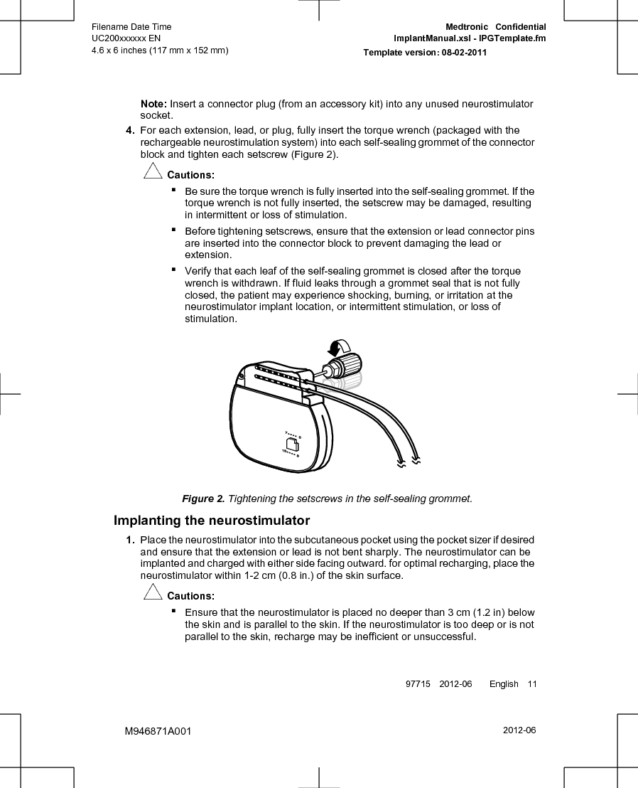 Note: Insert a connector plug (from an accessory kit) into any unused neurostimulatorsocket.4. For each extension, lead, or plug, fully insert the torque wrench (packaged with therechargeable neurostimulation system) into each self-sealing grommet of the connectorblock and tighten each setscrew (Figure 2).#Cautions:▪Be sure the torque wrench is fully inserted into the self-sealing grommet. If thetorque wrench is not fully inserted, the setscrew may be damaged, resultingin intermittent or loss of stimulation.▪Before tightening setscrews, ensure that the extension or lead connector pinsare inserted into the connector block to prevent damaging the lead orextension.▪Verify that each leaf of the self-sealing grommet is closed after the torquewrench is withdrawn. If fluid leaks through a grommet seal that is not fullyclosed, the patient may experience shocking, burning, or irritation at theneurostimulator implant location, or intermittent stimulation, or loss ofstimulation.Figure 2. Tightening the setscrews in the self-sealing grommet.Implanting the neurostimulator1. Place the neurostimulator into the subcutaneous pocket using the pocket sizer if desiredand ensure that the extension or lead is not bent sharply. The neurostimulator can beimplanted and charged with either side facing outward. for optimal recharging, place theneurostimulator within 1-2 cm (0.8 in.) of the skin surface.#Cautions:▪Ensure that the neurostimulator is placed no deeper than 3 cm (1.2 in) belowthe skin and is parallel to the skin. If the neurostimulator is too deep or is notparallel to the skin, recharge may be inefficient or unsuccessful.97715 2012-06  English 112012-06Filename Date TimeUC200xxxxxx EN4.6 x 6 inches (117 mm x 152 mm)Medtronic  ConfidentialImplantManual.xsl - IPGTemplate.fmTemplate version: 08-02-2011M946871A001