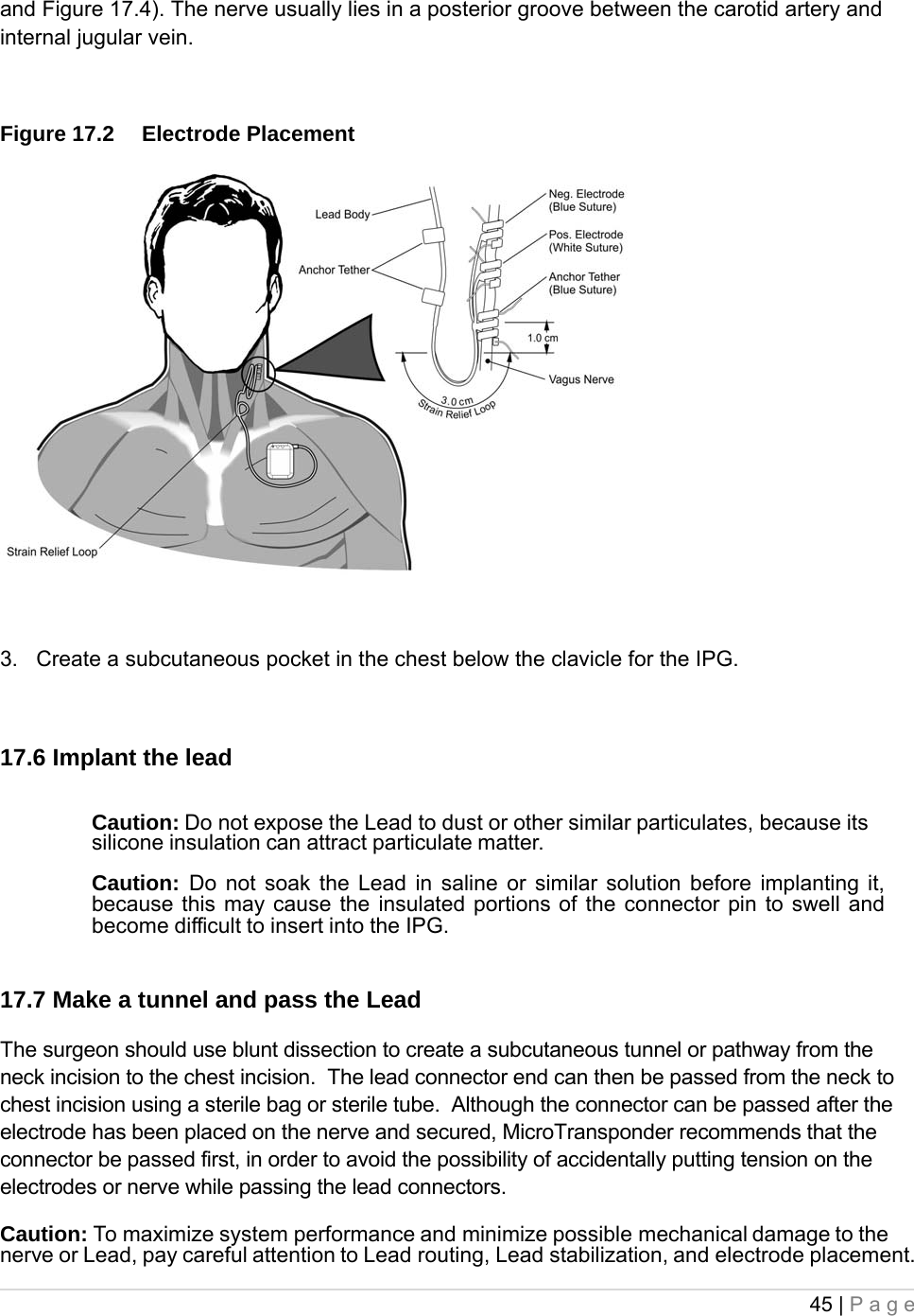 45 | Page  and Figure 17.4). The nerve usually lies in a posterior groove between the carotid artery and internal jugular vein.  Figure 17.2  Electrode Placement   3.   Create a subcutaneous pocket in the chest below the clavicle for the IPG.  17.6 Implant the lead  Caution: Do not expose the Lead to dust or other similar particulates, because its silicone insulation can attract particulate matter.  Caution:  Do not soak the Lead in saline or similar solution before implanting it, because this may cause the insulated portions of the connector pin to swell and become difficult to insert into the IPG.  17.7 Make a tunnel and pass the Lead The surgeon should use blunt dissection to create a subcutaneous tunnel or pathway from the neck incision to the chest incision.  The lead connector end can then be passed from the neck to chest incision using a sterile bag or sterile tube.  Although the connector can be passed after the electrode has been placed on the nerve and secured, MicroTransponder recommends that the connector be passed first, in order to avoid the possibility of accidentally putting tension on the electrodes or nerve while passing the lead connectors.  Caution: To maximize system performance and minimize possible mechanical damage to the nerve or Lead, pay careful attention to Lead routing, Lead stabilization, and electrode placement. 