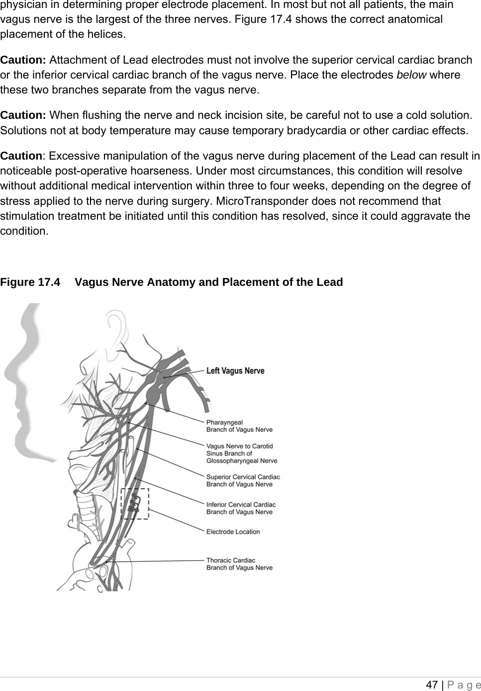 47 | Page  physician in determining proper electrode placement. In most but not all patients, the main vagus nerve is the largest of the three nerves. Figure 17.4 shows the correct anatomical placement of the helices. Caution: Attachment of Lead electrodes must not involve the superior cervical cardiac branch or the inferior cervical cardiac branch of the vagus nerve. Place the electrodes below where these two branches separate from the vagus nerve. Caution: When flushing the nerve and neck incision site, be careful not to use a cold solution.  Solutions not at body temperature may cause temporary bradycardia or other cardiac effects.   Caution: Excessive manipulation of the vagus nerve during placement of the Lead can result in noticeable post-operative hoarseness. Under most circumstances, this condition will resolve without additional medical intervention within three to four weeks, depending on the degree of stress applied to the nerve during surgery. MicroTransponder does not recommend that stimulation treatment be initiated until this condition has resolved, since it could aggravate the condition.  Figure 17.4  Vagus Nerve Anatomy and Placement of the Lead   