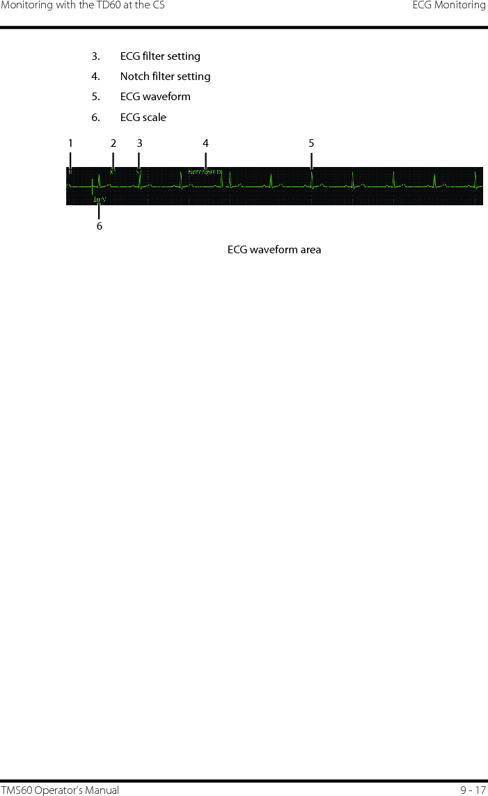 Monitoring with the TD60 at the CS ECG MonitoringTMS60 Operator’s Manual 9 - 173. ECG filter setting4. Notch filter setting5. ECG waveform6. ECG scaleECG waveform area1234 56