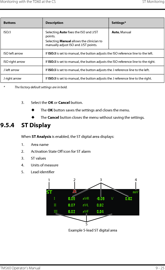 Monitoring with the TD60 at the CS ST MonitoringTMS60 Operator’s Manual 9 - 253. Select the OK or Cancel button.◆The OK button saves the settings and closes the menu.◆The Cancel button closes the menu without saving the settings.9.5.4 ST DisplayWhen ST Analysis is enabled, the ST digital area displays:1. Area name 2. Activation State Off icon for ST alarm3. ST values4. Units of measure5. Lead identifierExample 5-lead ST digital areaISO/J Selecting Auto fixes the ISO and J/ST points.Selecting Manual allows the clinician to manually adjust ISO and J/ST points. Auto, ManualISO left arrow If ISO/J is set to manual, the button adjusts the ISO reference line to the left.ISO right arrow If ISO/J is set to manual, the button adjusts the ISO reference line to the right.J left arrow If ISO/J is set to manual, the button adjusts the J reference line to the left.J right arrow If ISO/J is set to manual, the button adjusts the J reference line to the right.Buttons Description Settings** The factory default settings are in bold.12453