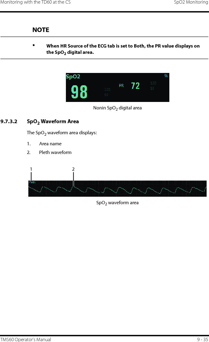 Monitoring with the TD60 at the CS SpO2 MonitoringTMS60 Operator’s Manual 9 - 35Nonin SpO2 digital area9.7.3.2 SpO2 Waveform AreaThe SpO2 waveform area displays:1. Area name2. Pleth waveformSpO2 waveform areaNOTE•When HR Source of the ECG tab is set to Both, the PR value displays on the SpO2 digital area.12