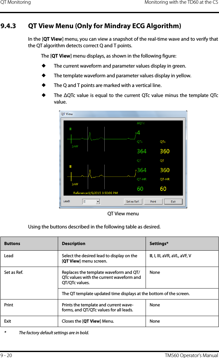 QT Monitoring Monitoring with the TD60 at the CS9 - 20 TMS60 Operator’s Manual9.4.3 QT View Menu (Only for Mindray ECG Algorithm)In the [QT View] menu, you can view a snapshot of the real-time wave and to verify thatthe QT algorithm detects correct Q and T points.The [QT View] menu displays, as shown in the following figure:◆The current waveform and parameter values display in green.◆The template waveform and parameter values display in yellow.◆The Q and T points are marked with a vertical line.◆The  ∆QTc value is equal to the current QTc value minus the template QTcvalue.QT View menuUsing the buttons described in the following table as desired.Buttons Description Settings*Lead Select the desired lead to display on the [QT View] menu screen.II, I, III, aVR, aVL, aVF, VSet as Ref. Replaces the template waveform and QT/QTc values with the current waveform and QT/QTc values.NoneThe QT template updated time displays at the bottom of the screen.Print Prints the template and current wave-forms, and QT/QTc values for all leads.NoneExit Closes the [QT View] Menu. None* The factory default settings are in bold.