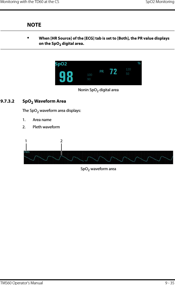 Monitoring with the TD60 at the CS SpO2 MonitoringTMS60 Operator’s Manual 9 - 35Nonin SpO2 digital area9.7.3.2 SpO2 Waveform AreaThe SpO2 waveform area displays:1. Area name2. Pleth waveformSpO2 waveform areaNOTE•When [HR Source] of the [ECG] tab is set to [Both], the PR value displays on the SpO2 digital area.12
