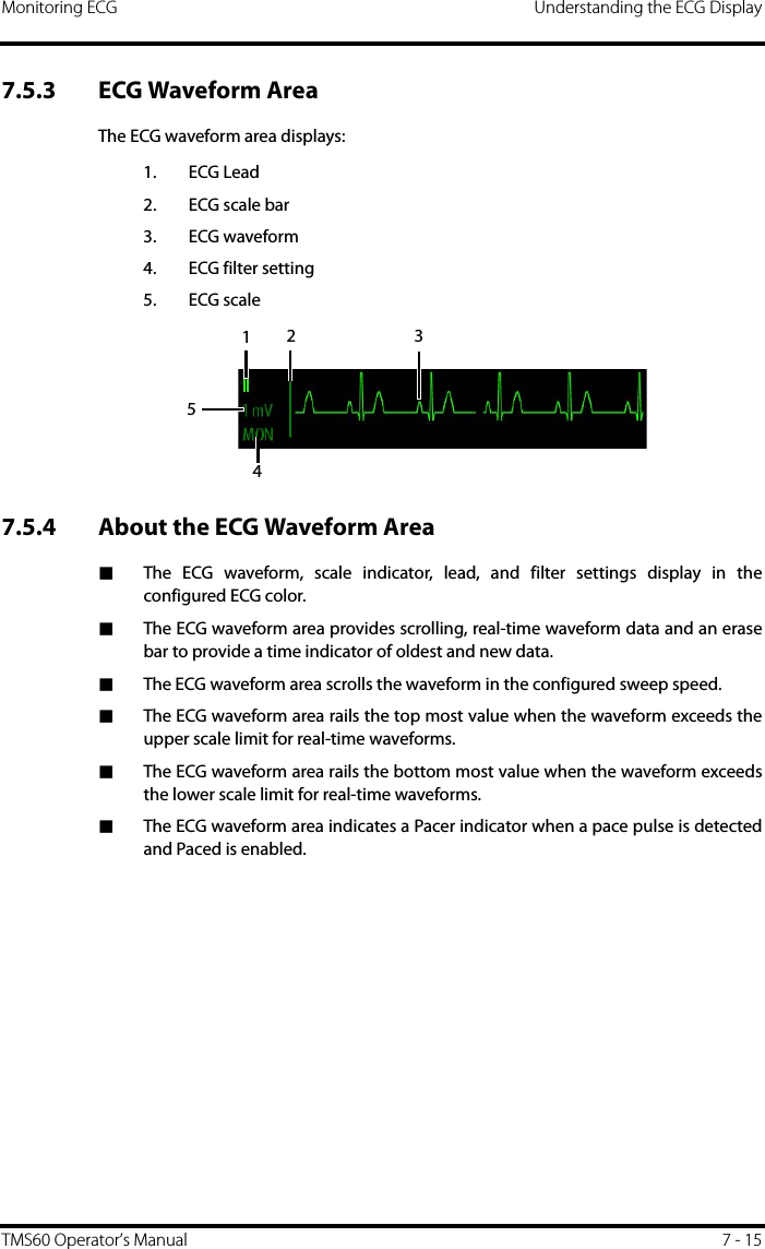 Monitoring ECG Understanding the ECG DisplayTMS60 Operator’s Manual 7 - 157.5.3 ECG Waveform AreaThe ECG waveform area displays:1. ECG Lead2. ECG scale bar3. ECG waveform4. ECG filter setting5. ECG scale7.5.4 About the ECG Waveform Area■The ECG waveform, scale indicator, lead, and filter settings display in theconfigured ECG color.■The ECG waveform area provides scrolling, real-time waveform data and an erasebar to provide a time indicator of oldest and new data.■The ECG waveform area scrolls the waveform in the configured sweep speed.■The ECG waveform area rails the top most value when the waveform exceeds theupper scale limit for real-time waveforms.■The ECG waveform area rails the bottom most value when the waveform exceedsthe lower scale limit for real-time waveforms.■The ECG waveform area indicates a Pacer indicator when a pace pulse is detectedand Paced is enabled.13452