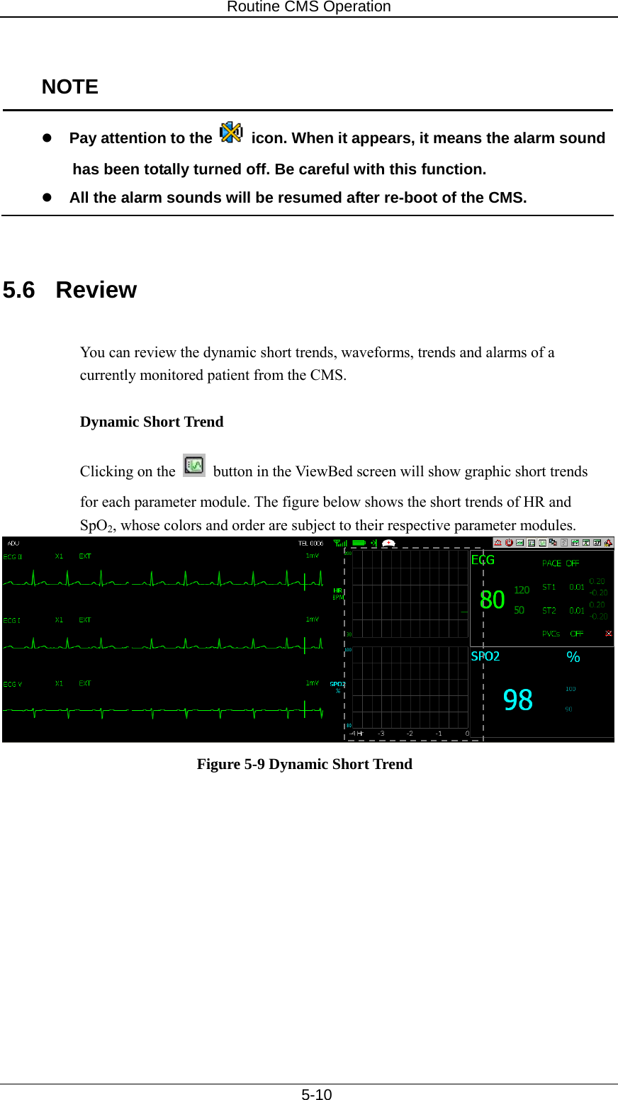 Routine CMS Operation   5-10  NOTE z Pay attention to the    icon. When it appears, it means the alarm sound has been totally turned off. Be careful with this function.   z All the alarm sounds will be resumed after re-boot of the CMS.     5.6 Review  You can review the dynamic short trends, waveforms, trends and alarms of a currently monitored patient from the CMS.  Dynamic Short Trend Clicking on the    button in the ViewBed screen will show graphic short trends for each parameter module. The figure below shows the short trends of HR and SpO2, whose colors and order are subject to their respective parameter modules.  Figure 5-9 Dynamic Short Trend 