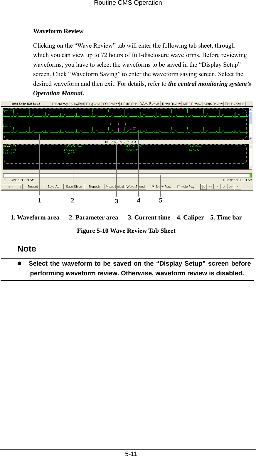 Routine CMS Operation   5-11  Waveform Review Clicking on the “Wave Review” tab will enter the following tab sheet, through which you can view up to 72 hours of full-disclosure waveforms. Before reviewing waveforms, you have to select the waveforms to be saved in the “Display Setup” screen. Click “Waveform Saving” to enter the waveform saving screen. Select the desired waveform and then exit. For details, refer to the central monitoring system’s Operation Manual.    1. Waveform area   2. Parameter area   3. Current time  4. Caliper  5. Time bar Figure 5-10 Wave Review Tab Sheet Note z Select the waveform to be saved on the “Display Setup” screen before performing waveform review. Otherwise, waveform review is disabled.  1 2  5 3  4 