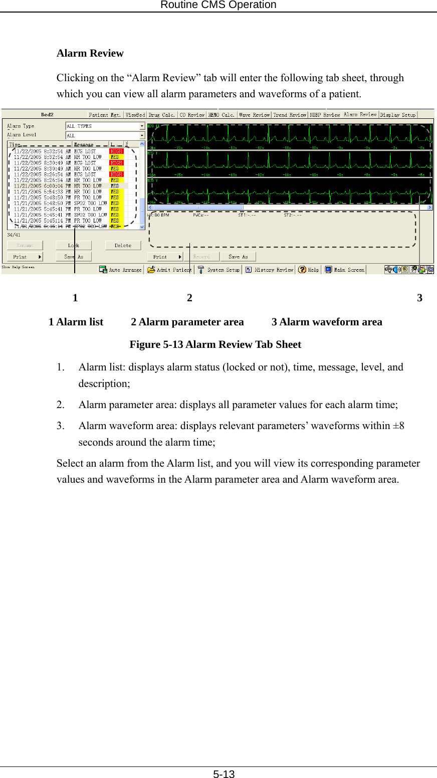 Routine CMS Operation   5-13  Alarm Review Clicking on the “Alarm Review” tab will enter the following tab sheet, through which you can view all alarm parameters and waveforms of a patient.    1 Alarm list     2 Alarm parameter area     3 Alarm waveform area Figure 5-13 Alarm Review Tab Sheet 1.  Alarm list: displays alarm status (locked or not), time, message, level, and description; 2.  Alarm parameter area: displays all parameter values for each alarm time; 3.  Alarm waveform area: displays relevant parameters’ waveforms within ±8 seconds around the alarm time; Select an alarm from the Alarm list, and you will view its corresponding parameter values and waveforms in the Alarm parameter area and Alarm waveform area.    1  2  3