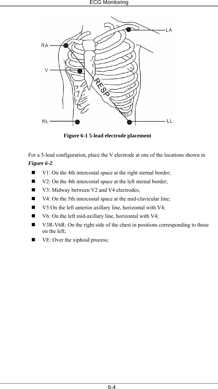 ECG Monitoring   6-4  Figure 6-1 5-lead electrode placement  For a 5-lead configuration, place the V electrode at one of the locations shown in Figure 6-2.   V1: On the 4th intercostal space at the right sternal border;  V2: On the 4th intercostal space at the left sternal border;  V3: Midway between V2 and V4 electrodes;  V4: On the 5th intercostal space at the mid-clavicular line;  V5:On the left anterior axillary line, horizontal with V4;  V6: On the left mid-axillary line, horizontal with V4;  V3R-V6R: On the right side of the chest in positions corresponding to those on the left;  VE: Over the xiphoid process; 