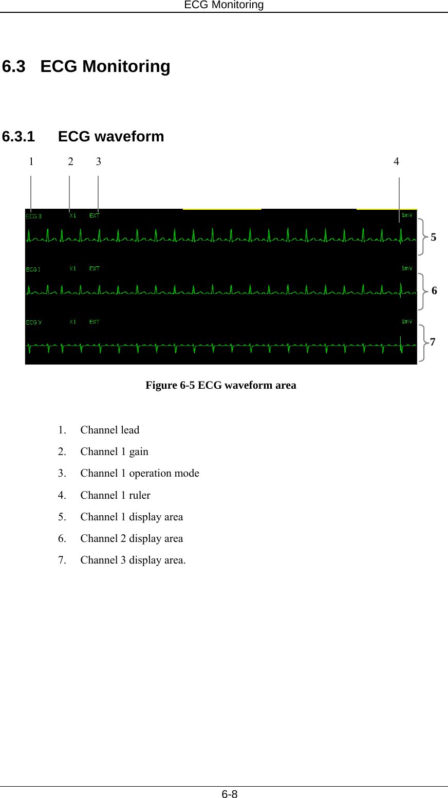 ECG Monitoring   6-8  6.3 ECG Monitoring   6.3.1 ECG waveform 1      2    3                                                    4    Figure 6-5 ECG waveform area  1. Channel lead 2. Channel 1 gain 3.  Channel 1 operation mode 4. Channel 1 ruler 5.  Channel 1 display area 6.  Channel 2 display area 7.  Channel 3 display area.   5 6 7 