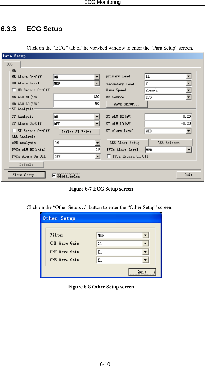 ECG Monitoring   6-10  6.3.3 ECG Setup  Click on the “ECG” tab of the viewbed window to enter the “Para Setup” screen.      Figure 6-7 ECG Setup screen  Click on the “Other Setup…” button to enter the “Other Setup” screen.    Figure 6-8 Other Setup screen  