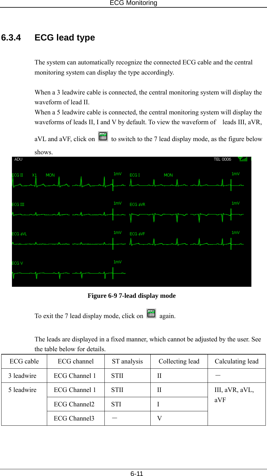 ECG Monitoring   6-11  6.3.4  ECG lead type  The system can automatically recognize the connected ECG cable and the central monitoring system can display the type accordingly.    When a 3 leadwire cable is connected, the central monitoring system will display the waveform of lead II. When a 5 leadwire cable is connected, the central monitoring system will display the waveforms of leads II, I and V by default. To view the waveform of    leads III, aVR, aVL and aVF, click on    to switch to the 7 lead display mode, as the figure below shows.   Figure 6-9 7-lead display mode To exit the 7 lead display mode, click on   again.    The leads are displayed in a fixed manner, which cannot be adjusted by the user. See the table below for details.   ECG cable  ECG channel  ST analysis  Collecting lead  Calculating lead 3 leadwire  ECG Channel 1  STII  II  － ECG Channel 1  STII  II ECG Channel2  STI  I 5 leadwire ECG Channel3  － V III, aVR, aVL, aVF  