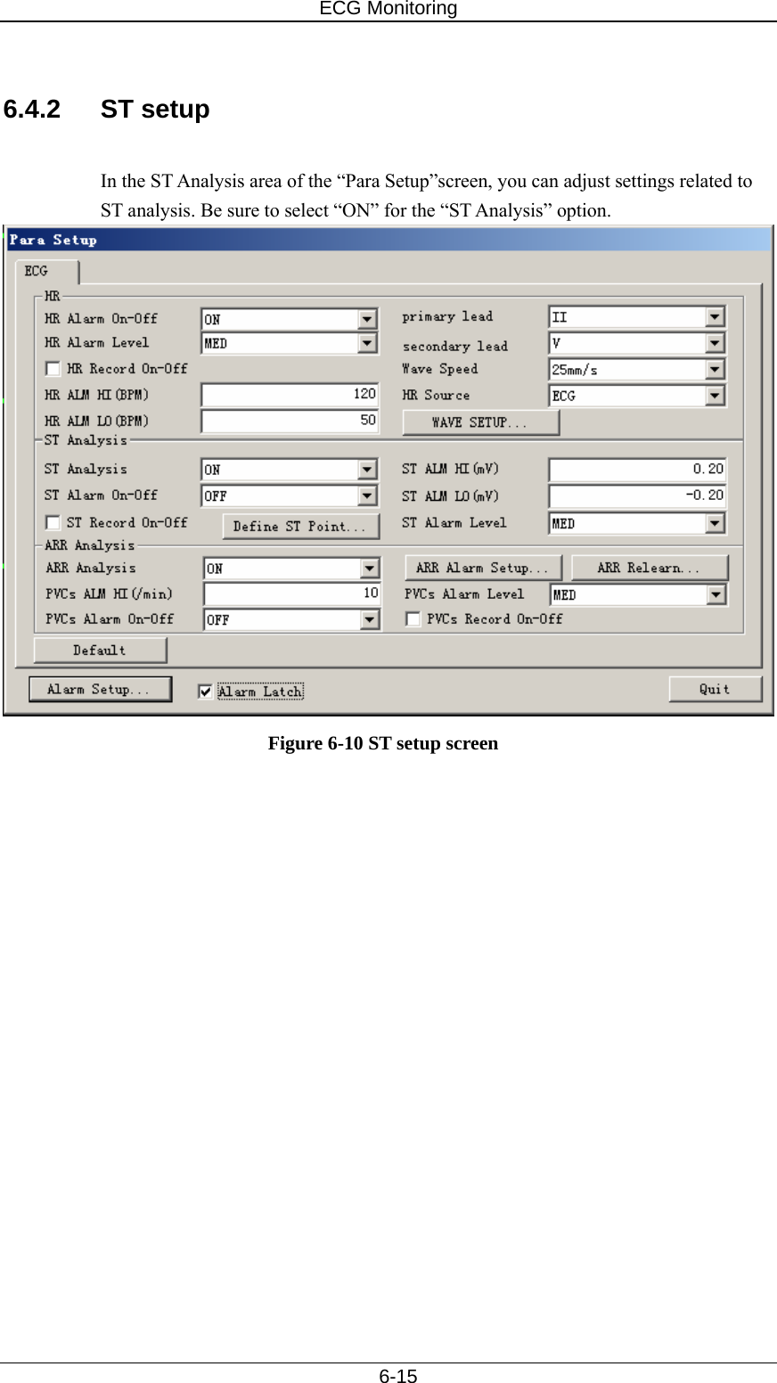 ECG Monitoring   6-15  6.4.2 ST setup  In the ST Analysis area of the “Para Setup”screen, you can adjust settings related to ST analysis. Be sure to select “ON” for the “ST Analysis” option.    Figure 6-10 ST setup screen 