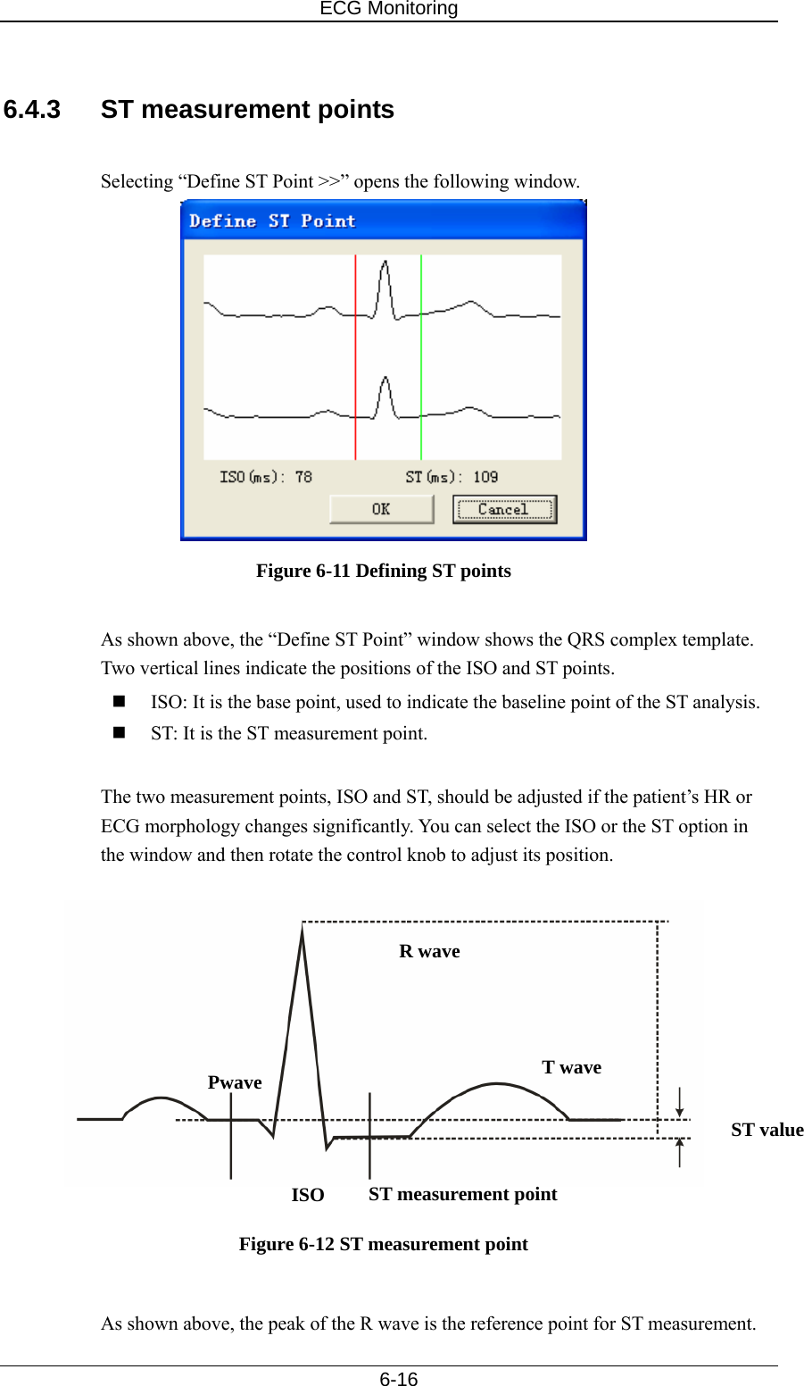 ECG Monitoring   6-16  6.4.3  ST measurement points  Selecting “Define ST Point &gt;&gt;” opens the following window.  Figure 6-11 Defining ST points  As shown above, the “Define ST Point” window shows the QRS complex template. Two vertical lines indicate the positions of the ISO and ST points.  ISO: It is the base point, used to indicate the baseline point of the ST analysis.    ST: It is the ST measurement point.    The two measurement points, ISO and ST, should be adjusted if the patient’s HR or ECG morphology changes significantly. You can select the ISO or the ST option in the window and then rotate the control knob to adjust its position.    Figure 6-12 ST measurement point  As shown above, the peak of the R wave is the reference point for ST measurement. R wave Pwave  T waveISO  ST measurement pointST value 