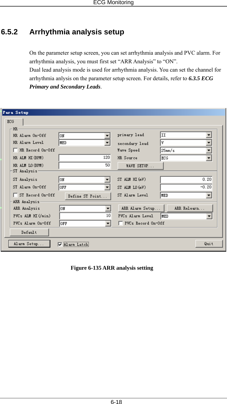 ECG Monitoring   6-18  6.5.2  Arrhythmia analysis setup  On the parameter setup screen, you can set arrhythmia analysis and PVC alarm. For arrhythmia analysis, you must first set “ARR Analysis” to “ON”. Dual lead analysis mode is used for arrhythmia analysis. You can set the channel for arrhythmia anlysis on the parameter setup screen. For details, refer to 6.3.5 ECG Primary and Secondary Leads.     Figure 6-135 ARR analysis setting  