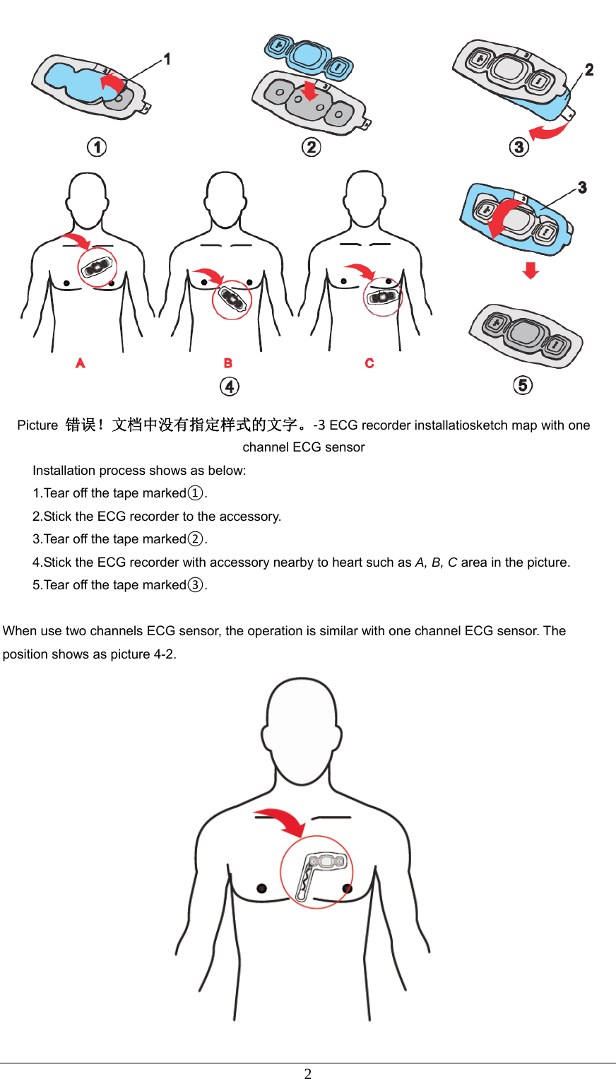  2  Picture  错误！文档中没有指定样式的文字。‐3ECG recorder installatiosketch map with one channel ECG sensor Installation process shows as below: 1.Tear off the tape marked①. 2.Stick the ECG recorder to the accessory. 3.Tear off the tape marked②. 4.Stick the ECG recorder with accessory nearby to heart such as A, B, C area in the picture. 5.Tear off the tape marked③.  When use two channels ECG sensor, the operation is similar with one channel ECG sensor. The position shows as picture 4-2. 