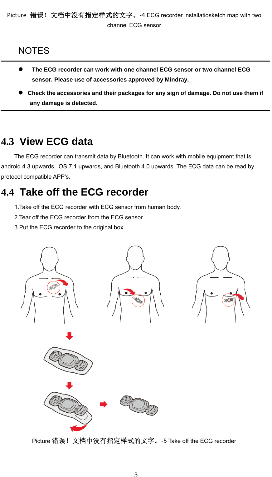  3 Picture错误！文档中没有指定样式的文字。‐4ECG recorder installatiosketch map with two channel ECG sensor NOTES  The ECG recorder can work with one channel ECG sensor or two channel ECG sensor. Please use of accessories approved by Mindray.  Check the accessories and their packages for any sign of damage. Do not use them if any damage is detected.   4.3  View ECG data   The ECG recorder can transmit data by Bluetooth. It can work with mobile equipment that is android 4.3 upwards, iOS 7.1 upwards, and Bluetooth 4.0 upwards. The ECG data can be read by protocol compatible APP’s. 4.4  Take off the ECG recorder 1.Take off the ECG recorder with ECG sensor from human body. 2.Tear off the ECG recorder from the ECG sensor 3.Put the ECG recorder to the original box.   Picture 错误！文档中没有指定样式的文字。‐5 Take off the ECG recorder 