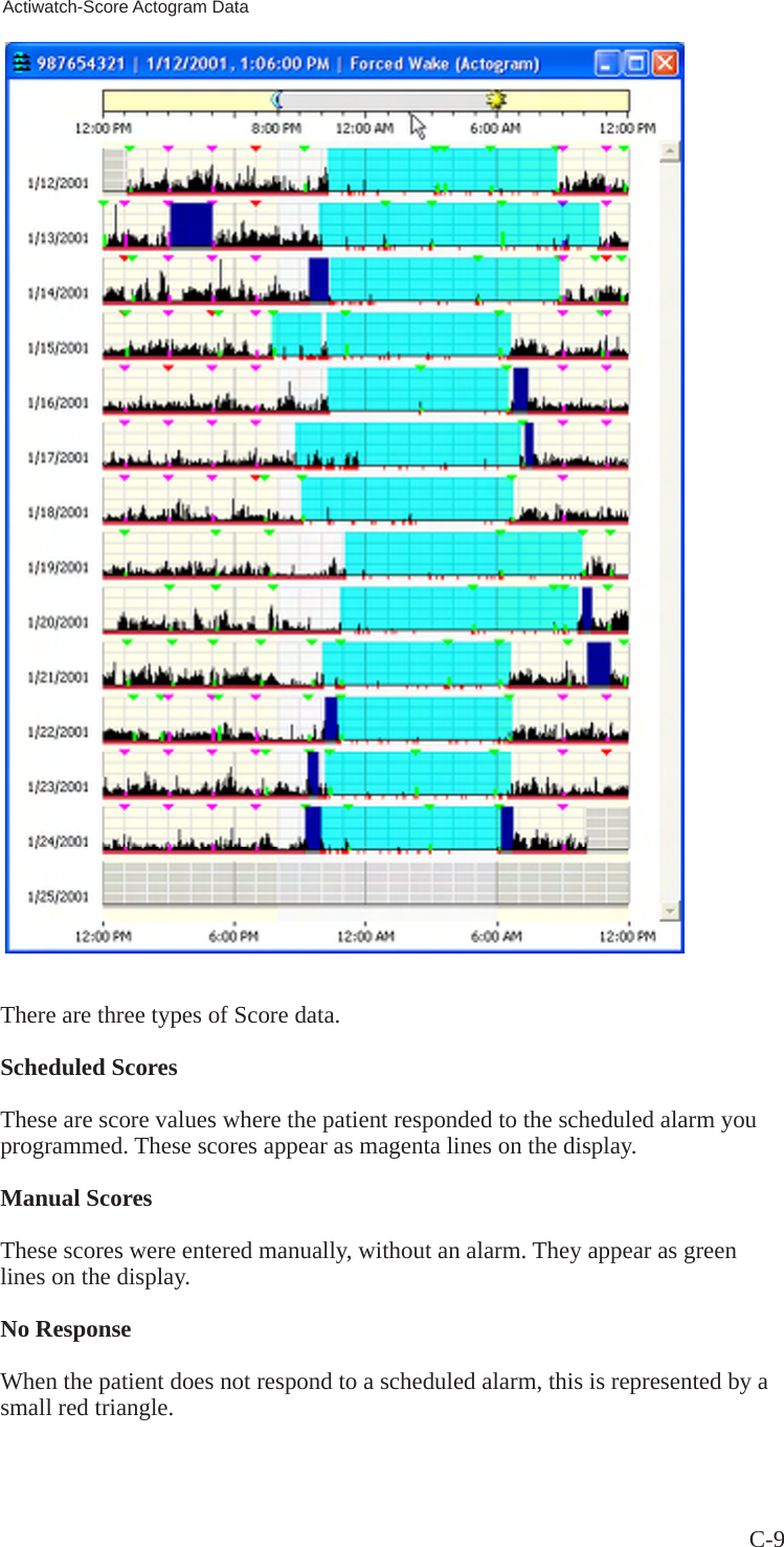 C-9 Actiwatch-Score Actogram DataThere are three types of Score data.Scheduled Scores These are score values where the patient responded to the scheduled alarm you programmed. These scores appear as magenta lines on the display.Manual Scores  These scores were entered manually, without an alarm. They appear as green lines on the display.No Response  When the patient does not respond to a scheduled alarm, this is represented by a small red triangle.