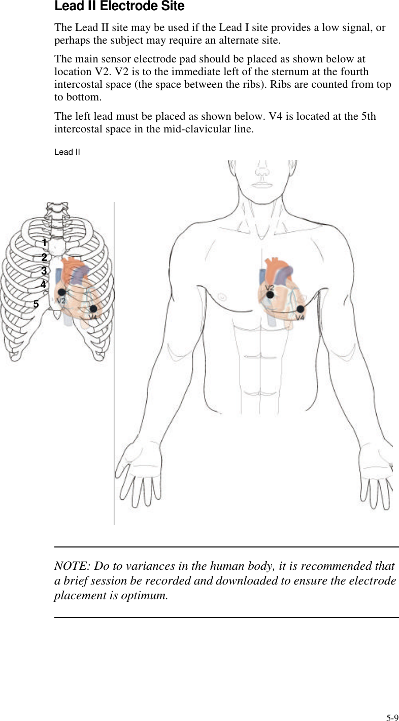 5-9Lead II Electrode SiteThe Lead II site may be used if the Lead I site provides a low signal, or perhaps the subject may require an alternate site. The main sensor electrode pad should be placed as shown below at location V2. V2 is to the immediate left of the sternum at the fourth intercostal space (the space between the ribs). Ribs are counted from top to bottom.The left lead must be placed as shown below. V4 is located at the 5th intercostal space in the mid-clavicular line.Lead IINOTE: Do to variances in the human body, it is recommended that a brief session be recorded and downloaded to ensure the electrode placement is optimum.12345