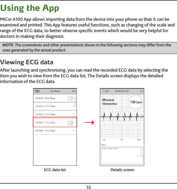 13Using the AppMiCor A100 App allows importing data from the device into your phone so that it can be examined and printed. This App features useful functions, such as changing of the scale and range of the ECG data, to better observe speciﬁc events which would be very helpful for doctors in making their diagnosis.NOTE: The screenshots and other presentations shown in the following sections may differ from the ones generated by the actual product.Viewing ECG dataAfter launching and synchronising, you can read the recorded ECG data by selecting the item you wish to view from the ECG data list. The Details screen displays the detailed information of the ECG data.ECG data list Details screen