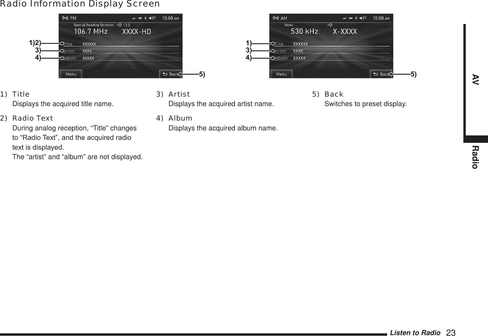 Listen to Radio   23AV RadioRadio Information Display Screen1)2)3)4)3)1)4)5) 5)1) Title  Displays the acquired title name.2) Radio Text  During analog reception, “Title” changes WR³5DGLR7H[W´DQGWKHDFTXLUHGUDGLRWH[WLVGLVSOD\HG The “artist” and “album” are not displayed.3) Artist  Displays the acquired artist name.4) Album  Displays the acquired album name.5) Back  Switches to preset display.