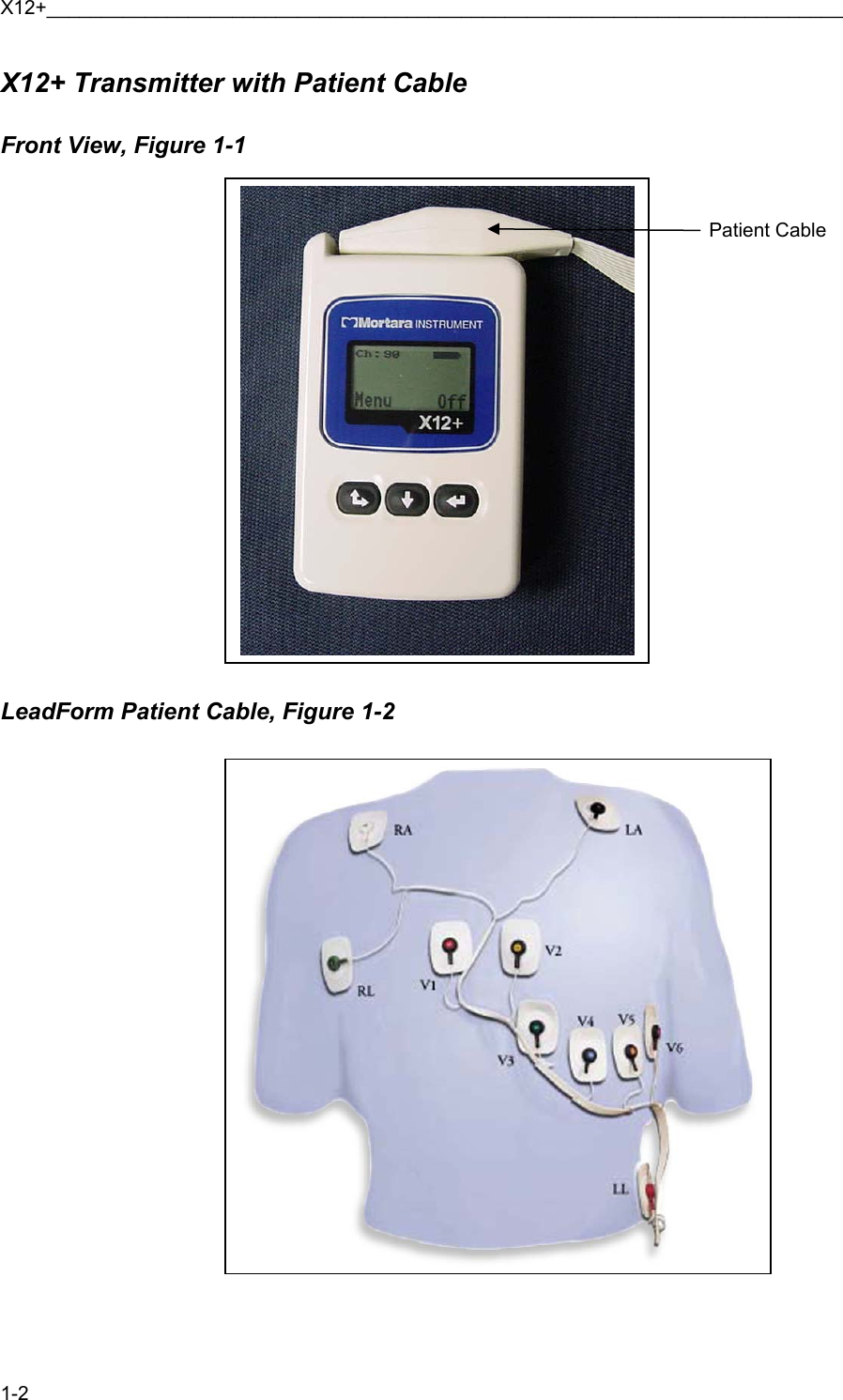 X12+_________________________________________________________________________ 1-2 X12+ Transmitter with Patient Cable  Front View, Figure 1-1                          LeadForm Patient Cable, Figure 1-2                         Patient Cable  