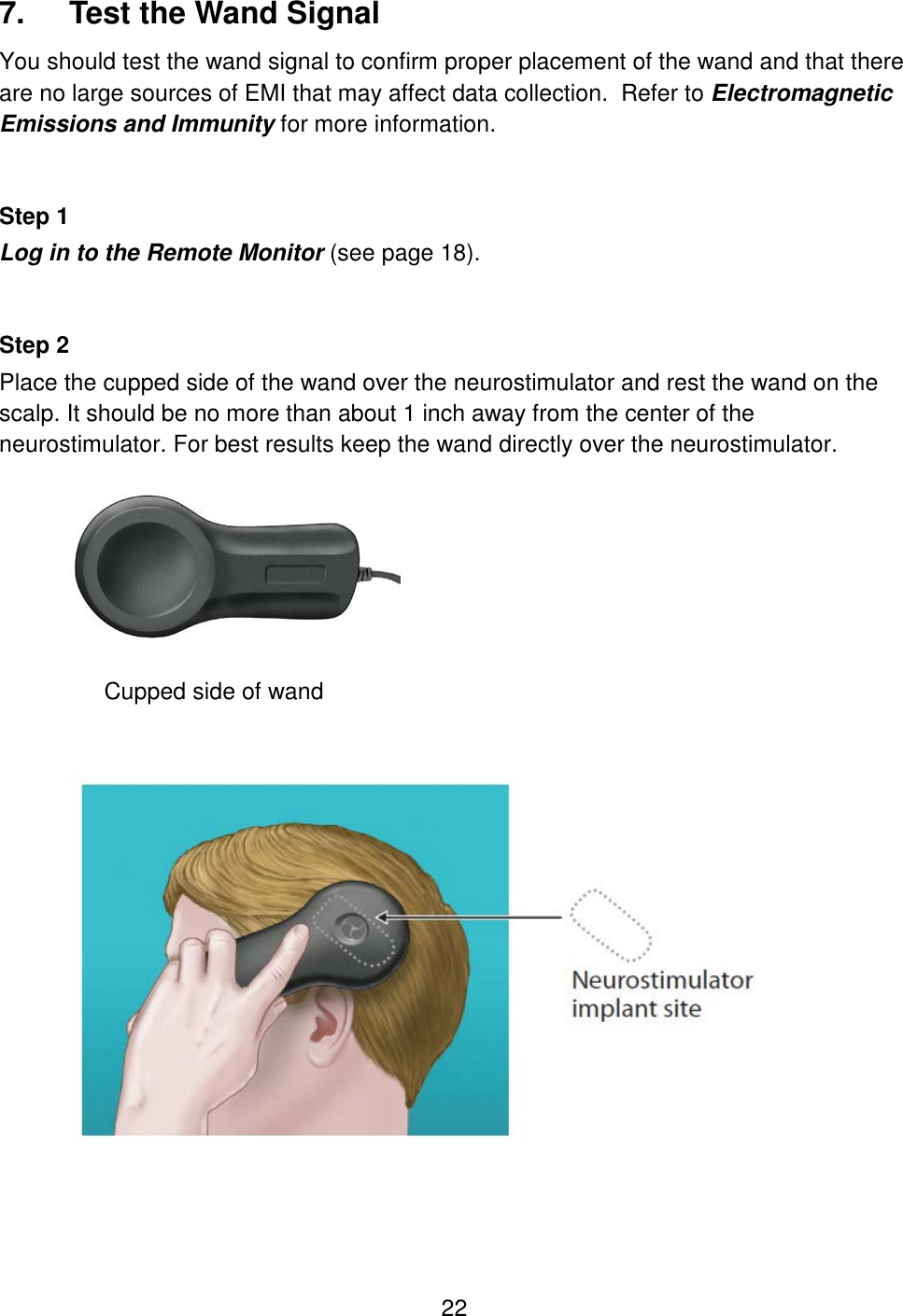 22 7.  Test the Wand Signal You should test the wand signal to confirm proper placement of the wand and that there are no large sources of EMI that may affect data collection.  Refer to Electromagnetic Emissions and Immunity for more information.   Step 1 Log in to the Remote Monitor (see page 18).   Step 2 Place the cupped side of the wand over the neurostimulator and rest the wand on the scalp. It should be no more than about 1 inch away from the center of the neurostimulator. For best results keep the wand directly over the neurostimulator.    Cupped side of wand      