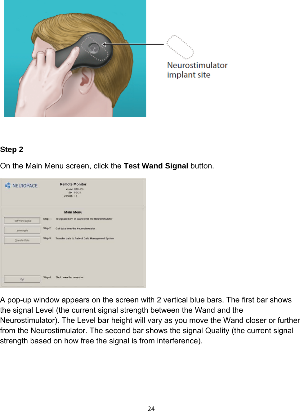      Step 2 On the Main Menu screen, click the Test Wand Signal button.   A pop-up window appears on the screen with 2 vertical blue bars. The first bar shows the signal Level (the current signal strength between the Wand and the Neurostimulator). The Level bar height will vary as you move the Wand closer or further from the Neurostimulator. The second bar shows the signal Quality (the current signal strength based on how free the signal is from interference).  24