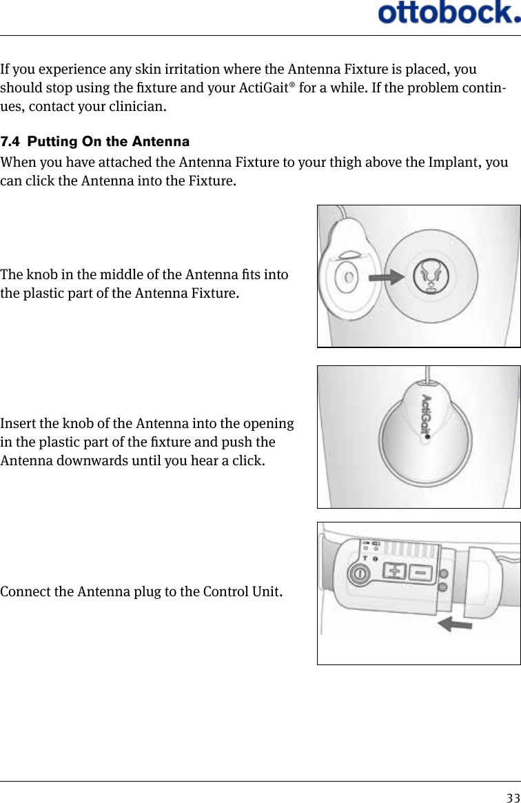 33If you experience any skin irritation where the Antenna Fixture is placed, you should stop using the xture and your ActiGait&reg; for a while. If the problem contin-ues, contact your clinician.7.4  Putting On the AntennaWhen you have attached the Antenna Fixture to your thigh above the Implant, you can click the Antenna into the Fixture. The knob in the middle of the Antenna ts into the plastic part of the Antenna Fixture.Insert the knob of the Antenna into the opening in the plastic part of the xture and push the Antenna downwards until you hear a click.Connect the Antenna plug to the Control Unit.