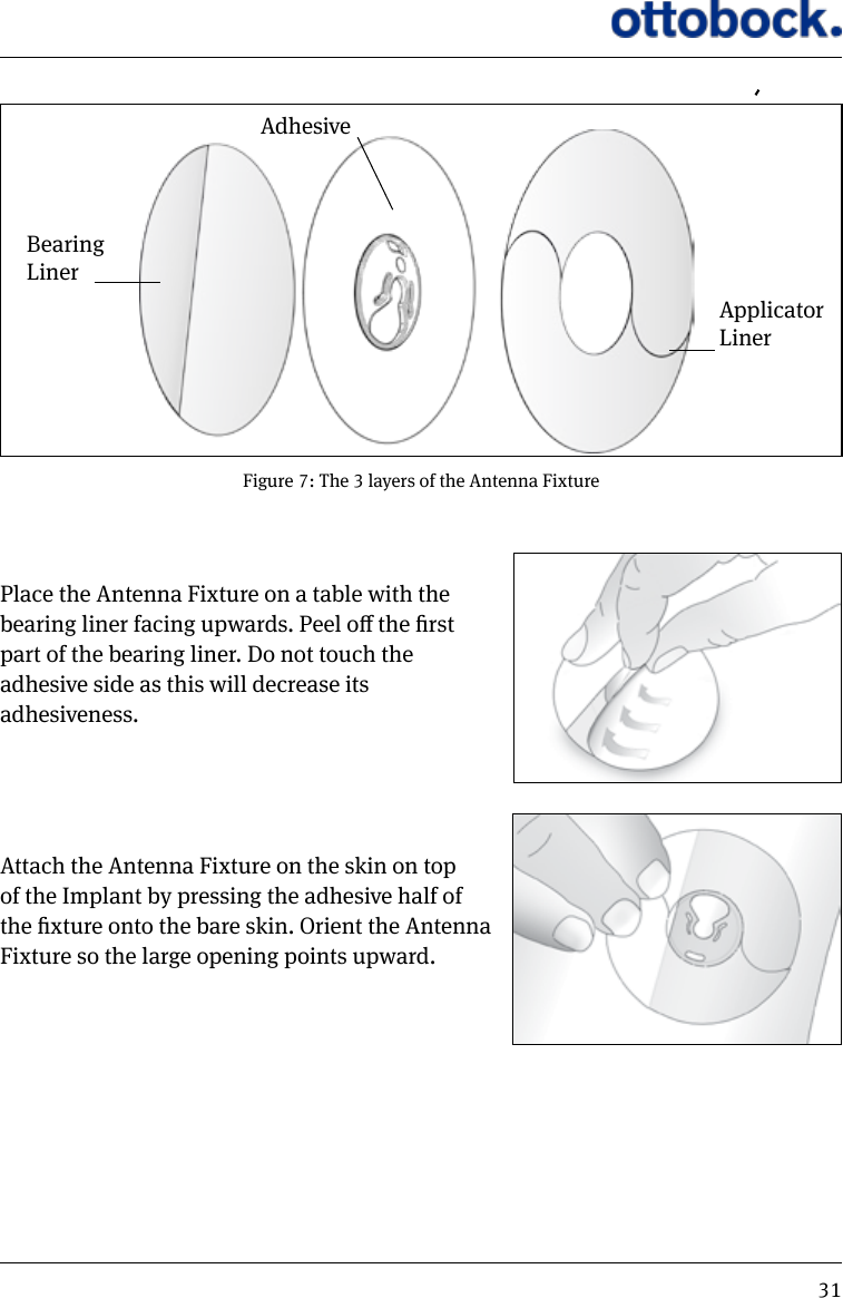 31Place the Antenna Fixture on a table with the bearing liner facing upwards. Peel o the rst part of the bearing liner. Do not touch theadhesive side as this will decrease its adhesiveness.Attach the Antenna Fixture on the skin on top of the Implant by pressing the adhesive half of the xture onto the bare skin. Orient the Antenna Fixture so the large opening points upward. Figure 7: The 3 layers of the Antenna FixtureBearing LinerAdhesiveApplicatorLiner