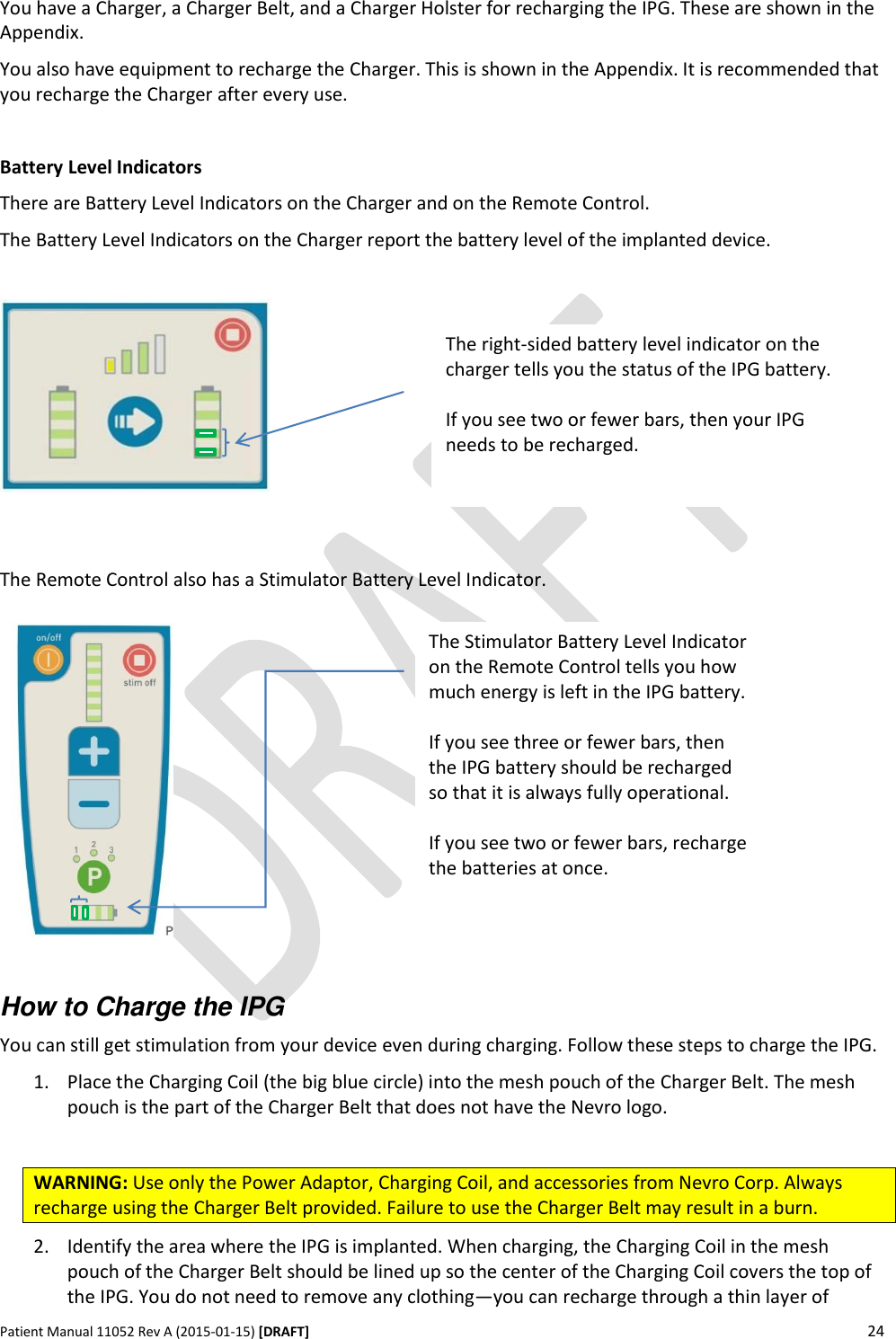      Patient Manual 11052 Rev A (2015-01-15) [DRAFT] 24   You have a Charger, a Charger Belt, and a Charger Holster for recharging the IPG. These are shown in the Appendix. You also have equipment to recharge the Charger. This is shown in the Appendix. It is recommended that you recharge the Charger after every use.  Battery Level Indicators There are Battery Level Indicators on the Charger and on the Remote Control. The Battery Level Indicators on the Charger report the battery level of the implanted device.      The Remote Control also has a Stimulator Battery Level Indicator.                How to Charge the IPG You can still get stimulation from your device even during charging. Follow these steps to charge the IPG. 1. Place the Charging Coil (the big blue circle) into the mesh pouch of the Charger Belt. The mesh pouch is the part of the Charger Belt that does not have the Nevro logo.  WARNING: Use only the Power Adaptor, Charging Coil, and accessories from Nevro Corp. Always recharge using the Charger Belt provided. Failure to use the Charger Belt may result in a burn.   2. Identify the area where the IPG is implanted. When charging, the Charging Coil in the mesh pouch of the Charger Belt should be lined up so the center of the Charging Coil covers the top of the IPG. You do not need to remove any clothing—you can recharge through a thin layer of The right-sided battery level indicator on the charger tells you the status of the IPG battery.  If you see two or fewer bars, then your IPG needs to be recharged.   The Stimulator Battery Level Indicator on the Remote Control tells you how much energy is left in the IPG battery.  If you see three or fewer bars, then the IPG battery should be recharged so that it is always fully operational.  If you see two or fewer bars, recharge the batteries at once. 