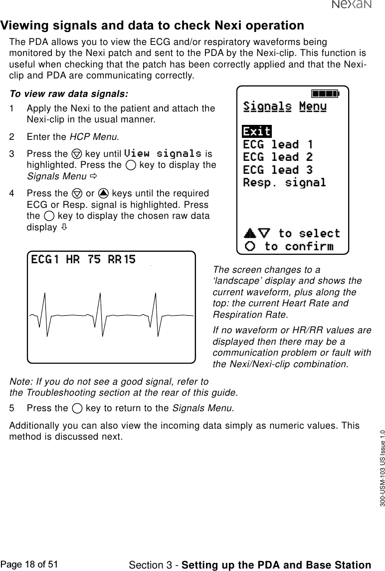 300-USM-103 US Issue 1.0Page 18 of 51 Section 3 - Setting up the PDA and Base StationViewing signals and data to check Nexi operationThe PDA allows you to view the ECG and/or respiratory waveforms beingmonitored by the Nexi patch and sent to the PDA by the Nexi-clip. This function isuseful when checking that the patch has been correctly applied and that the Nexi-clip and PDA are communicating correctly.To view raw data signals:1 Apply the Nexi to the patient and attach theNexi-clip in the usual manner.2 Enter the HCP Menu.3 Press the   key until   ishighlighted. Press the   key to display theSignals Menu ð4 Press the   or   keys until the requiredECG or Resp. signal is highlighted. Pressthe   key to display the chosen raw datadisplay òjkklSignals MenuECG lead 1ECG lead 2ECG lead 3Resp. signalcdefabto selectto confirmExit_______ ____ECG1 HR 75 RR15 SpO2 95The screen changes to a‘landscape’ display and shows thecurrent waveform, plus along thetop: the current Heart Rate andRespiration Rate.If no waveform or HR/RR values aredisplayed then there may be acommunication problem or fault withthe Nexi/Nexi-clip combination.Note: If you do not see a good signal, refer tothe Troubleshooting section at the rear of this guide.5 Press the   key to return to the Signals Menu.Additionally you can also view the incoming data simply as numeric values. Thismethod is discussed next.