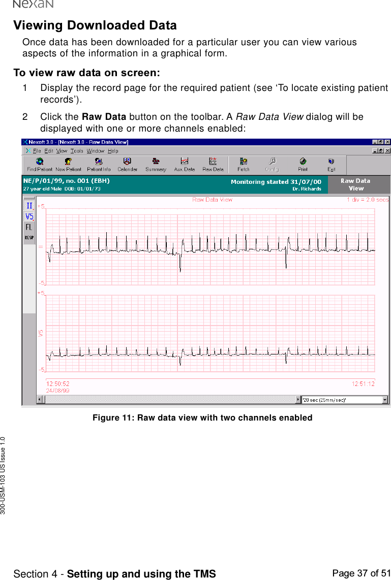 300-USM-103 US Issue 1.0Page 37 of 51Section 4 - Setting up and using the TMSViewing Downloaded DataOnce data has been downloaded for a particular user you can view variousaspects of the information in a graphical form.To view raw data on screen:1 Display the record page for the required patient (see ‘To locate existing patientrecords’).2 Click the Raw Data button on the toolbar. A Raw Data View dialog will bedisplayed with one or more channels enabled:Figure 11: Raw data view with two channels enabled