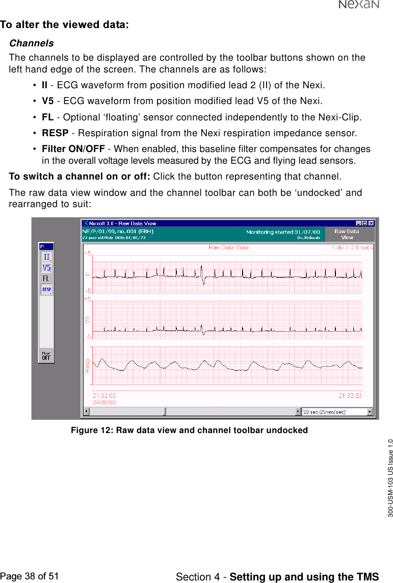 300-USM-103 US Issue 1.0Page 38 of 51 Section 4 - Setting up and using the TMSTo alter the viewed data:ChannelsThe channels to be displayed are controlled by the toolbar buttons shown on theleft hand edge of the screen. The channels are as follows:•II - ECG waveform from position modified lead 2 (II) of the Nexi.•V5 - ECG waveform from position modified lead V5 of the Nexi.•FL - Optional ‘floating’ sensor connected independently to the Nexi-Clip.•RESP - Respiration signal from the Nexi respiration impedance sensor.•Filter ON/OFF - When enabled, this baseline filter compensates for changesin the overall voltage levels measured by the ECG and flying lead sensors.To switch a channel on or off: Click the button representing that channel.The raw data view window and the channel toolbar can both be ‘undocked’ andrearranged to suit:Figure 12: Raw data view and channel toolbar undocked