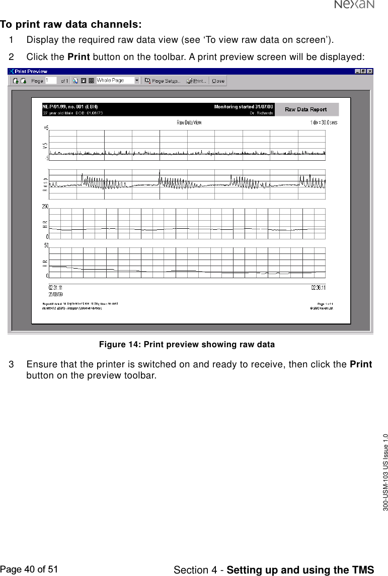 300-USM-103 US Issue 1.0Page 40 of 51 Section 4 - Setting up and using the TMSTo print raw data channels:1 Display the required raw data view (see ‘To view raw data on screen’).2 Click the Print button on the toolbar. A print preview screen will be displayed:Figure 14: Print preview showing raw data3 Ensure that the printer is switched on and ready to receive, then click the Printbutton on the preview toolbar.