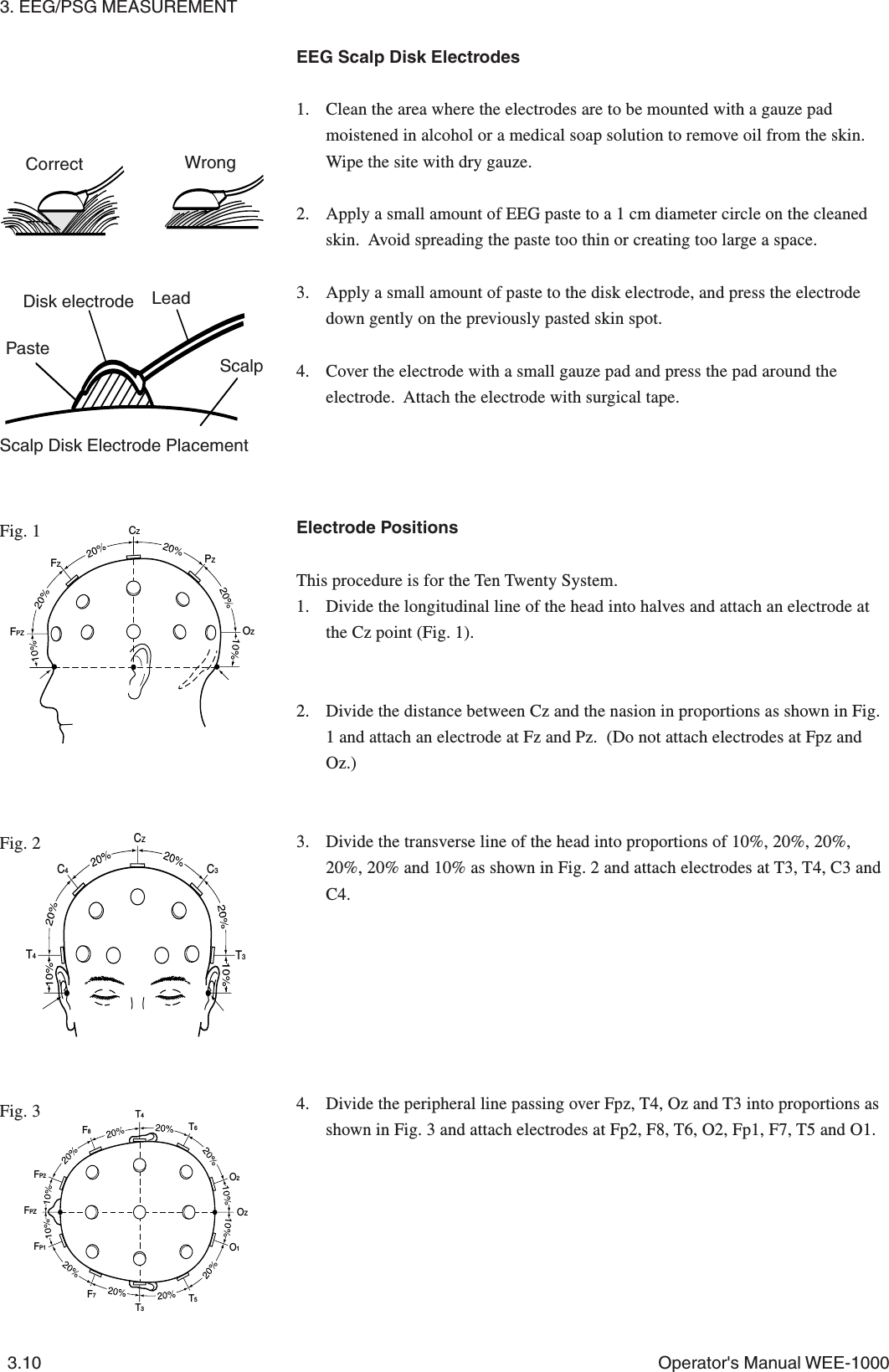 3. EEG/PSG MEASUREMENT3.10 Operator&apos;s Manual WEE-1000EEG Scalp Disk Electrodes1. Clean the area where the electrodes are to be mounted with a gauze padmoistened in alcohol or a medical soap solution to remove oil from the skin.Wipe the site with dry gauze.2. Apply a small amount of EEG paste to a 1 cm diameter circle on the cleanedskin.  Avoid spreading the paste too thin or creating too large a space.3. Apply a small amount of paste to the disk electrode, and press the electrodedown gently on the previously pasted skin spot.4. Cover the electrode with a small gauze pad and press the pad around theelectrode.  Attach the electrode with surgical tape.Electrode PositionsThis procedure is for the Ten Twenty System.1. Divide the longitudinal line of the head into halves and attach an electrode atthe Cz point (Fig. 1).2. Divide the distance between Cz and the nasion in proportions as shown in Fig.1 and attach an electrode at Fz and Pz.  (Do not attach electrodes at Fpz andOz.)3. Divide the transverse line of the head into proportions of 10%, 20%, 20%,20%, 20% and 10% as shown in Fig. 2 and attach electrodes at T3, T4, C3 andC4.4. Divide the peripheral line passing over Fpz, T4, Oz and T3 into proportions asshown in Fig. 3 and attach electrodes at Fp2, F8, T6, O2, Fp1, F7, T5 and O1.Fig. 1Fig. 2Fig. 3CZFZFPZPZOZT3T4C3CZC4FP2FP1FPZF8T4T3T5O1O2OZT6F7Disk electrode LeadPasteScalpScalp Disk Electrode PlacementCorrect Wrong