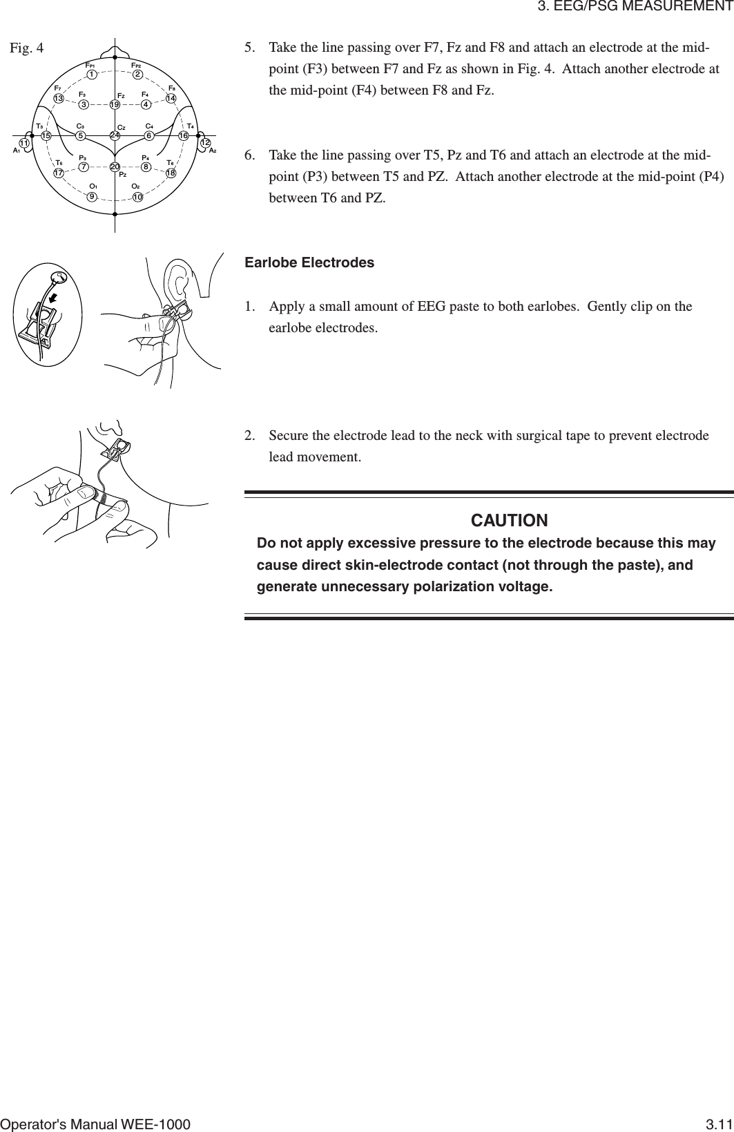 3. EEG/PSG MEASUREMENTOperator&apos;s Manual WEE-1000 3.115. Take the line passing over F7, Fz and F8 and attach an electrode at the mid-point (F3) between F7 and Fz as shown in Fig. 4.  Attach another electrode atthe mid-point (F4) between F8 and Fz.6. Take the line passing over T5, Pz and T6 and attach an electrode at the mid-point (P3) between T5 and PZ.  Attach another electrode at the mid-point (P4)between T6 and PZ.Earlobe Electrodes1. Apply a small amount of EEG paste to both earlobes.  Gently clip on theearlobe electrodes.2. Secure the electrode lead to the neck with surgical tape to prevent electrodelead movement.CAUTIONDo not apply excessive pressure to the electrode because this maycause direct skin-electrode contact (not through the paste), andgenerate unnecessary polarization voltage.Fig. 4F3F4F8F7FP1FP2FZCZPZP3P4C4C3T3A2A1T4T6T5O2O113 31219 414121662420 81857171511910