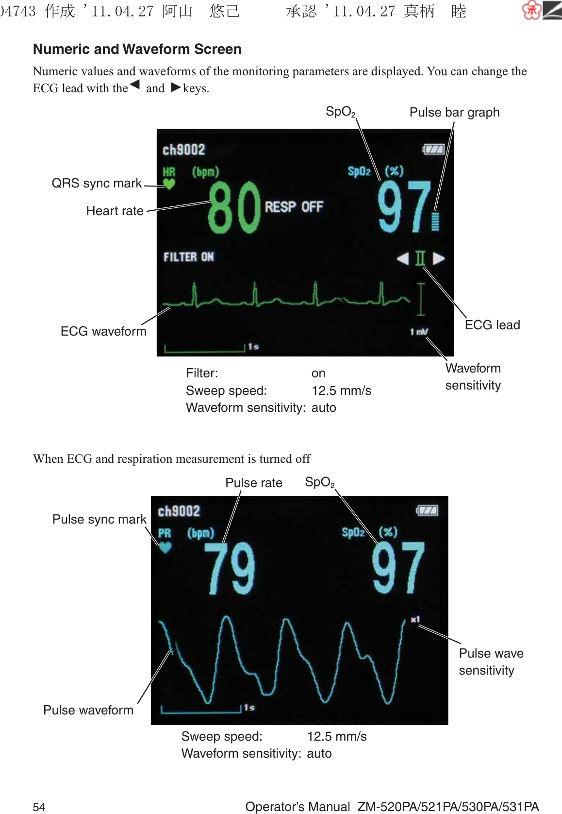 54  Operator’s Manual  ZM-520PA/521PA/530PA/531PANumeric and Waveform ScreenNumeric values and waveforms of the monitoring parameters are displayed. You can change the ECG lead with the ▼ and ▼ keys.Heart rateQRS sync markPulse bar graphSpO2ECG waveformFilter: onSweep speed:  12.5 mm/sWaveform sensitivity:  autoWaveform sensitivityECG leadWhen ECG and respiration measurement is turned offPulse ratePulse sync markSpO2Pulse wave sensitivityPulse waveformSweep speed:  12.5 mm/sWaveform sensitivity:  auto૞ᚑ㒙ጊޓᖘᏆ ᛚ⹺⌀ᨩޓ⌬