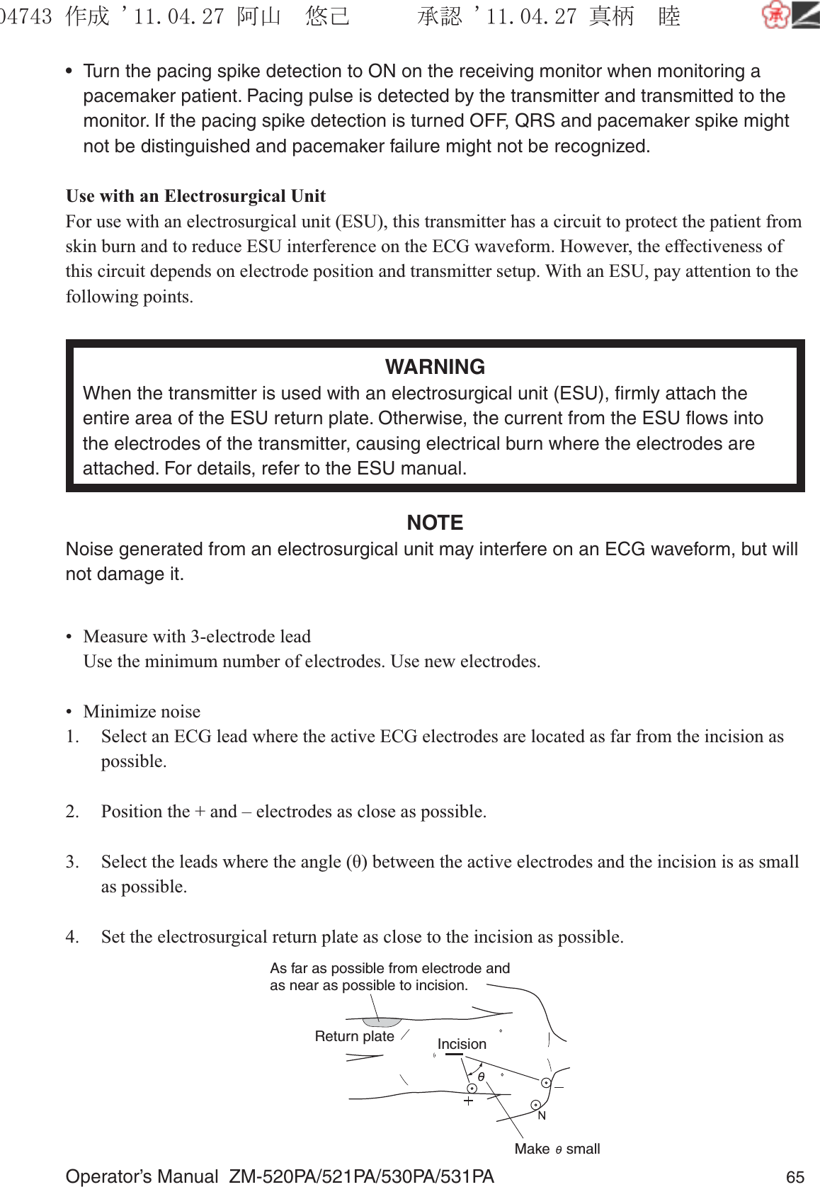 Operator’s Manual  ZM-520PA/521PA/530PA/531PA 65•  Turn the pacing spike detection to ON on the receiving monitor when monitoring a pacemaker patient. Pacing pulse is detected by the transmitter and transmitted to the monitor. If the pacing spike detection is turned OFF, QRS and pacemaker spike might not be distinguished and pacemaker failure might not be recognized.Use with an Electrosurgical UnitFor use with an electrosurgical unit (ESU), this transmitter has a circuit to protect the patient from skin burn and to reduce ESU interference on the ECG waveform. However, the effectiveness of this circuit depends on electrode position and transmitter setup. With an ESU, pay attention to the following points.WARNINGWhen the transmitter is used with an electrosurgical unit (ESU), ﬁrmly attach the entire area of the ESU return plate. Otherwise, the current from the ESU ﬂows into the electrodes of the transmitter, causing electrical burn where the electrodes are attached. For details, refer to the ESU manual.NOTENoise generated from an electrosurgical unit may interfere on an ECG waveform, but will not damage it.•  Measure with 3-electrode lead  Use the minimum number of electrodes. Use new electrodes.• Minimize noise1.  Select an ECG lead where the active ECG electrodes are located as far from the incision as possible.2.  Position the + and – electrodes as close as possible.3.  Select the leads where the angle (θ) between the active electrodes and the incision is as small as possible.4.  Set the electrosurgical return plate as close to the incision as possible.Make    smallIncisionReturn plateAs far as possible from electrode andas near as possible to incision.૞ᚑ㒙ጊޓᖘᏆ ᛚ⹺⌀ᨩޓ⌬