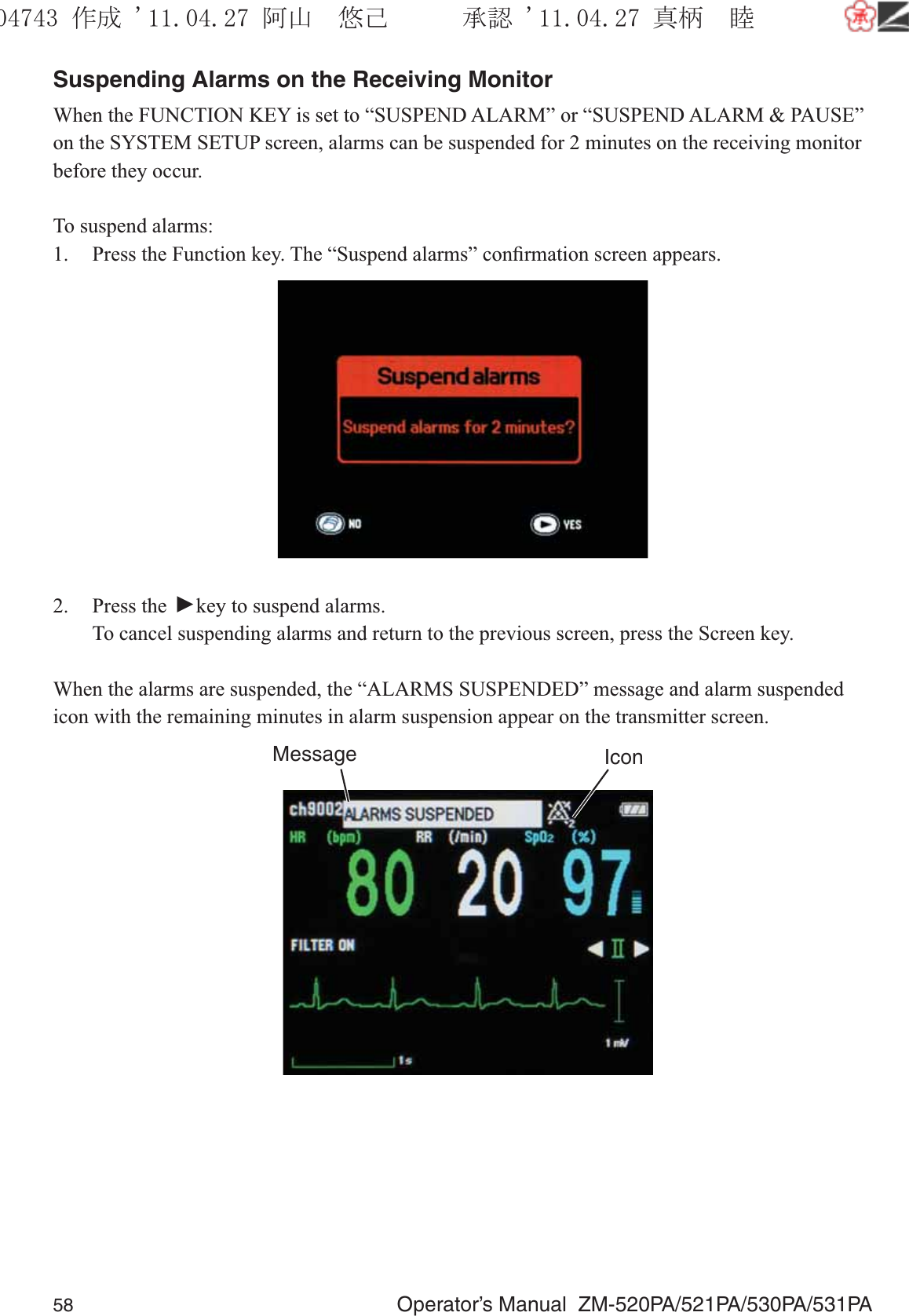 58  Operator’s Manual  ZM-520PA/521PA/530PA/531PASuspending Alarms on the Receiving MonitorWhen the FUNCTION KEY is set to “SUSPEND ALARM” or “SUSPEND ALARM &amp; PAUSE” on the SYSTEM SETUP screen, alarms can be suspended for 2 minutes on the receiving monitor before they occur.To suspend alarms:1.  Press the Function key. The “Suspend alarms” conﬁrmation screen appears.2. Press the ▼ key to suspend alarms.  To cancel suspending alarms and return to the previous screen, press the Screen key.When the alarms are suspended, the “ALARMS SUSPENDED” message and alarm suspended icon with the remaining minutes in alarm suspension appear on the transmitter screen.Message Icon૞ᚑ㒙ጊޓᖘᏆ ᛚ⹺⌀ᨩޓ⌬