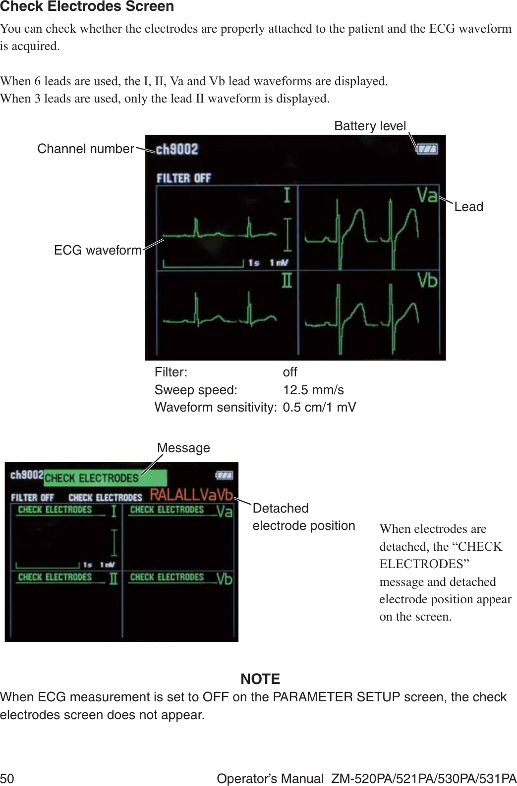 50  Operator’s Manual  ZM-520PA/521PA/530PA/531PACheck Electrodes Screen&lt;RXFDQFKHFNZKHWKHUWKHHOHFWURGHVDUHSURSHUO\DWWDFKHGWRWKHSDWLHQWDQGWKH(&amp;*ZDYHIRUPis acquired.:KHQOHDGVDUHXVHGWKH,,,9DDQG9EOHDGZDYHIRUPVDUHGLVSOD\HGWhen 3 leads are used, only the lead II waveform is displayed.Filter: offSweep speed:  12.5 mm/sWaveform sensitivity:  0.5 cm/1 mVECG waveformBattery levelLeadChannel numberDetached electrode positionMessage     When electrodes are GHWDFKHGWKH³&amp;+(&amp;.(/(&amp;752&apos;(6´message and detached electrode position appear on the screen.NOTEWhen ECG measurement is set to OFF on the PARAMETER SETUP screen, the check electrodes screen does not appear.