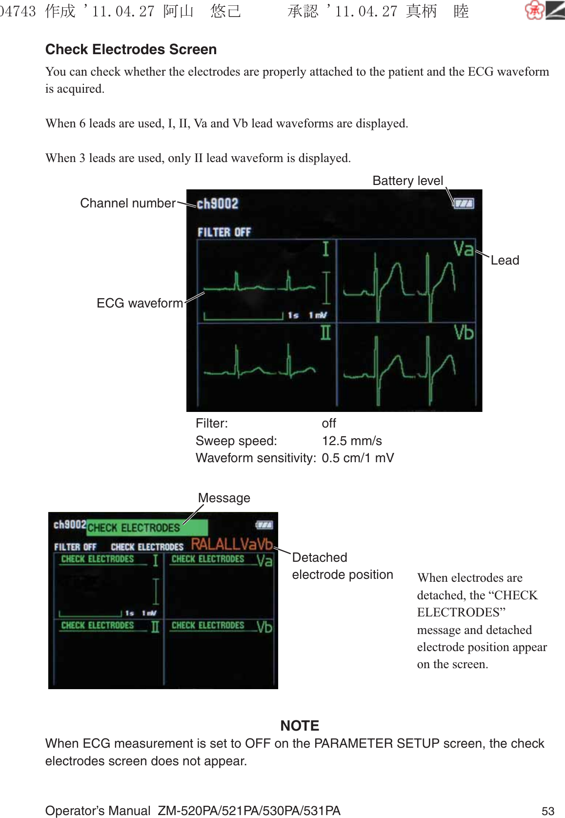 Operator’s Manual  ZM-520PA/521PA/530PA/531PA 53Check Electrodes ScreenYou can check whether the electrodes are properly attached to the patient and the ECG waveform is acquired.When 6 leads are used, I, II, Va and Vb lead waveforms are displayed.When 3 leads are used, only II lead waveform is displayed.Filter: offSweep speed:  12.5 mm/sWaveform sensitivity:  0.5 cm/1 mVECG waveformBattery levelLeadChannel numberDetached electrode positionMessage     When electrodes are detached, the “CHECK ELECTRODES” message and detached electrode position appear on the screen.NOTEWhen ECG measurement is set to OFF on the PARAMETER SETUP screen, the check electrodes screen does not appear.૞ᚑ㒙ጊޓᖘᏆ ᛚ⹺⌀ᨩޓ⌬