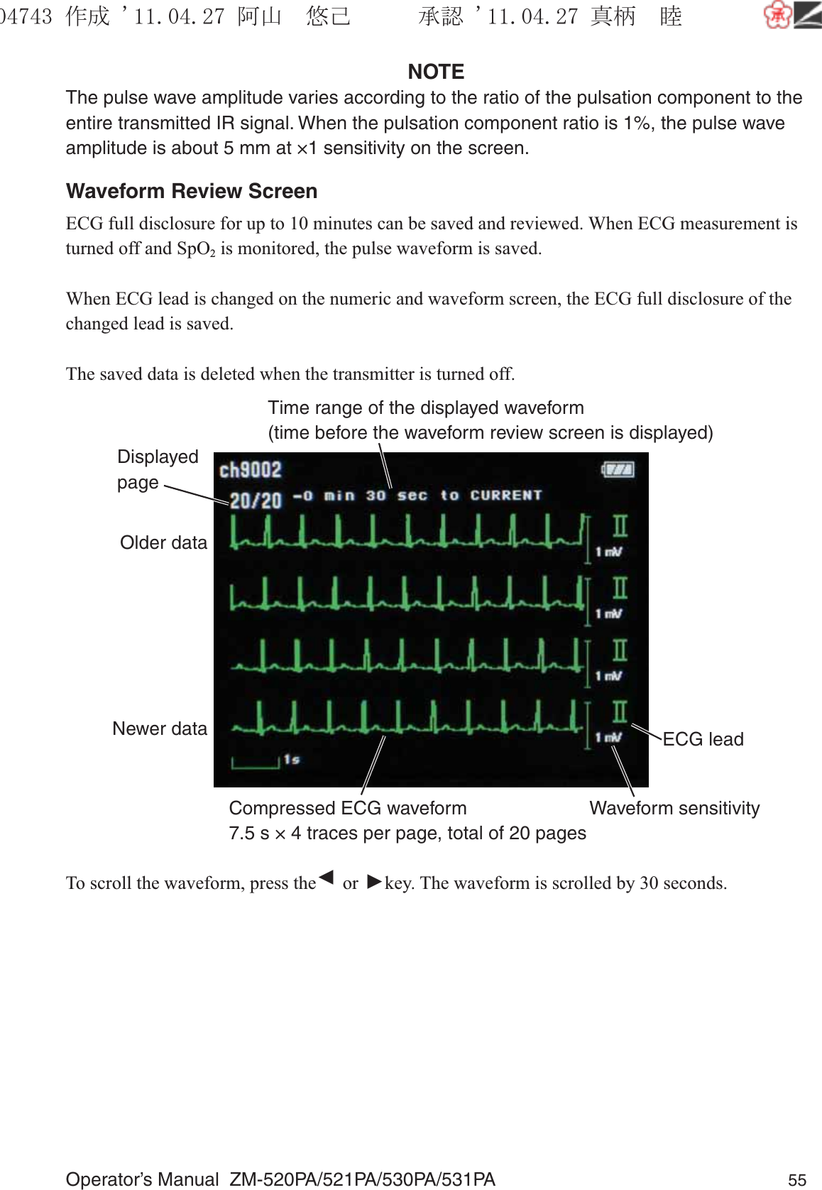 Operator’s Manual  ZM-520PA/521PA/530PA/531PA 55NOTEThe pulse wave amplitude varies according to the ratio of the pulsation component to the entire transmitted IR signal. When the pulsation component ratio is 1%, the pulse wave amplitude is about 5 mm at ×1 sensitivity on the screen.Waveform Review ScreenECG full disclosure for up to 10 minutes can be saved and reviewed. When ECG measurement is turned off and SpO2 is monitored, the pulse waveform is saved.When ECG lead is changed on the numeric and waveform screen, the ECG full disclosure of the changed lead is saved.The saved data is deleted when the transmitter is turned off.ECG leadDisplayed pageCompressed ECG waveform7.5 s × 4 traces per page, total of 20 pagesOlder dataNewer dataTime range of the displayed waveform (time before the waveform review screen is displayed)Waveform sensitivityTo scroll the waveform, press the ▼ or ▼ key. The waveform is scrolled by 30 seconds.૞ᚑ㒙ጊޓᖘᏆ ᛚ⹺⌀ᨩޓ⌬