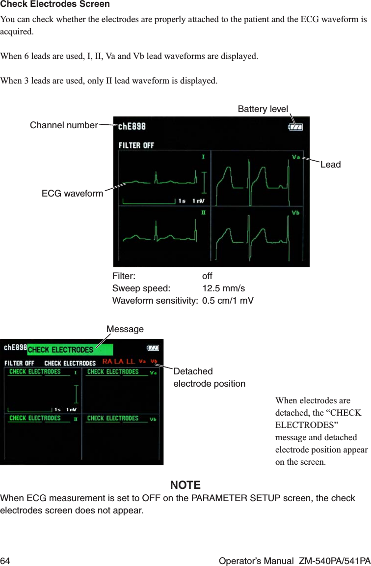 64  Operator’s Manual  ZM-540PA/541PACheck Electrodes ScreenYou can check whether the electrodes are properly attached to the patient and the ECG waveform is acquired.When 6 leads are used, I, II, Va and Vb lead waveforms are displayed.When 3 leads are used, only II lead waveform is displayed.Channel numberBattery levelECG waveformFilter: offSweep speed:  12.5 mm/sWaveform sensitivity:  0.5 cm/1 mVLeadDetached electrode positionMessage When electrodes are detached, the “CHECK ELECTRODES” message and detached electrode position appear on the screen.NOTEWhen ECG measurement is set to OFF on the PARAMETER SETUP screen, the check electrodes screen does not appear.